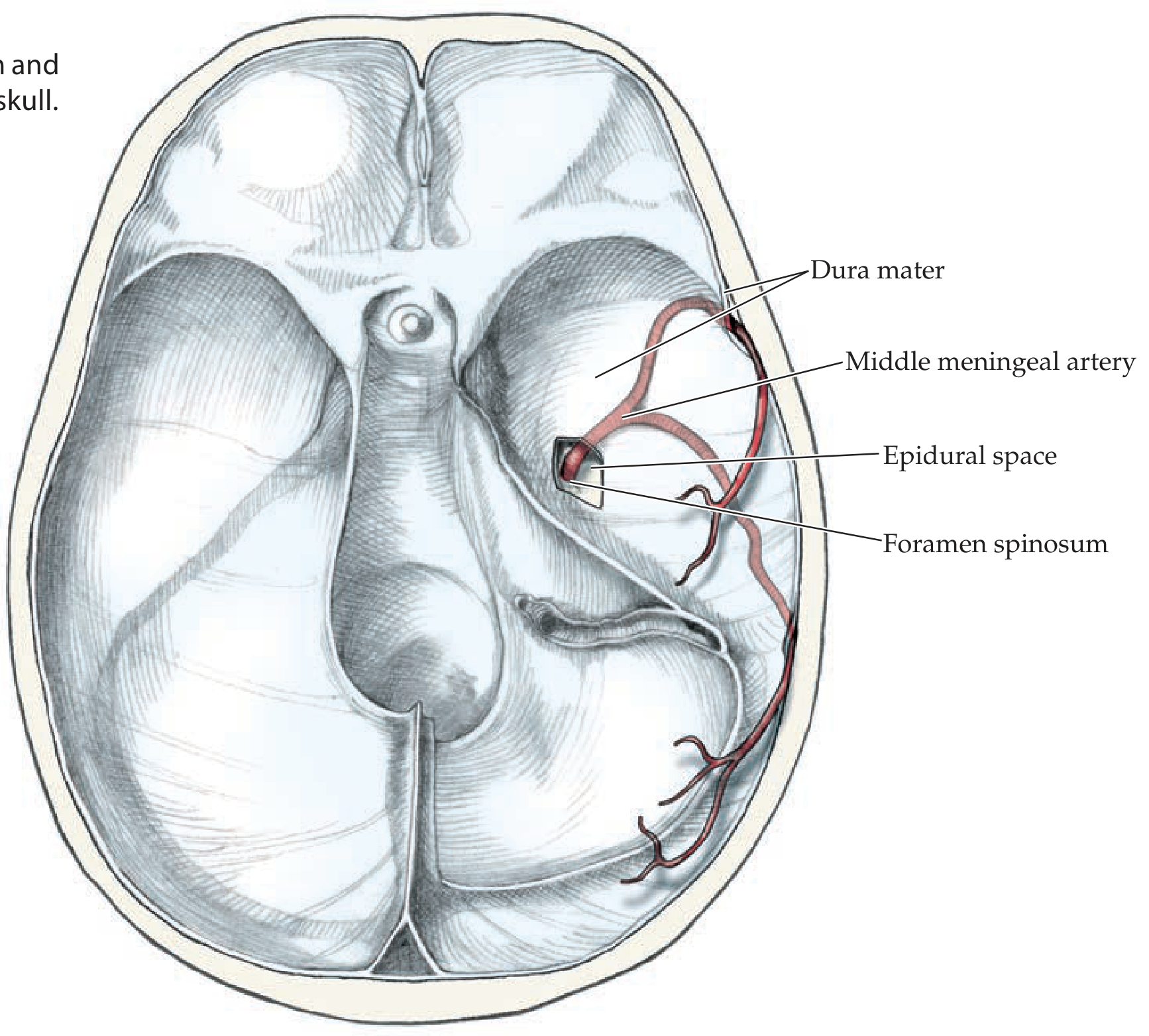 Middle meningeal artery entering foramen spinosum, running in epidural space between dura and skull
