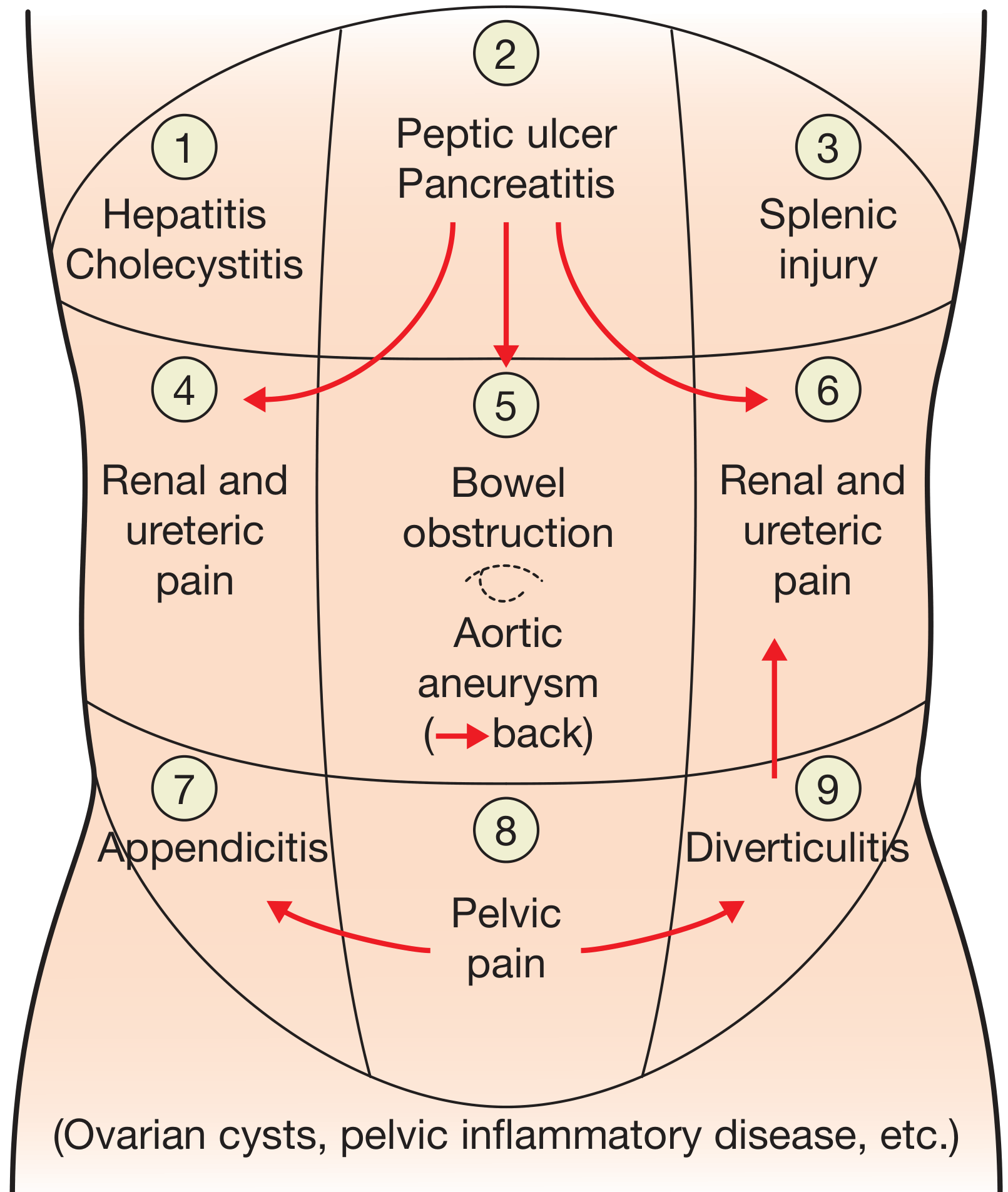 9-region abdominal pain map