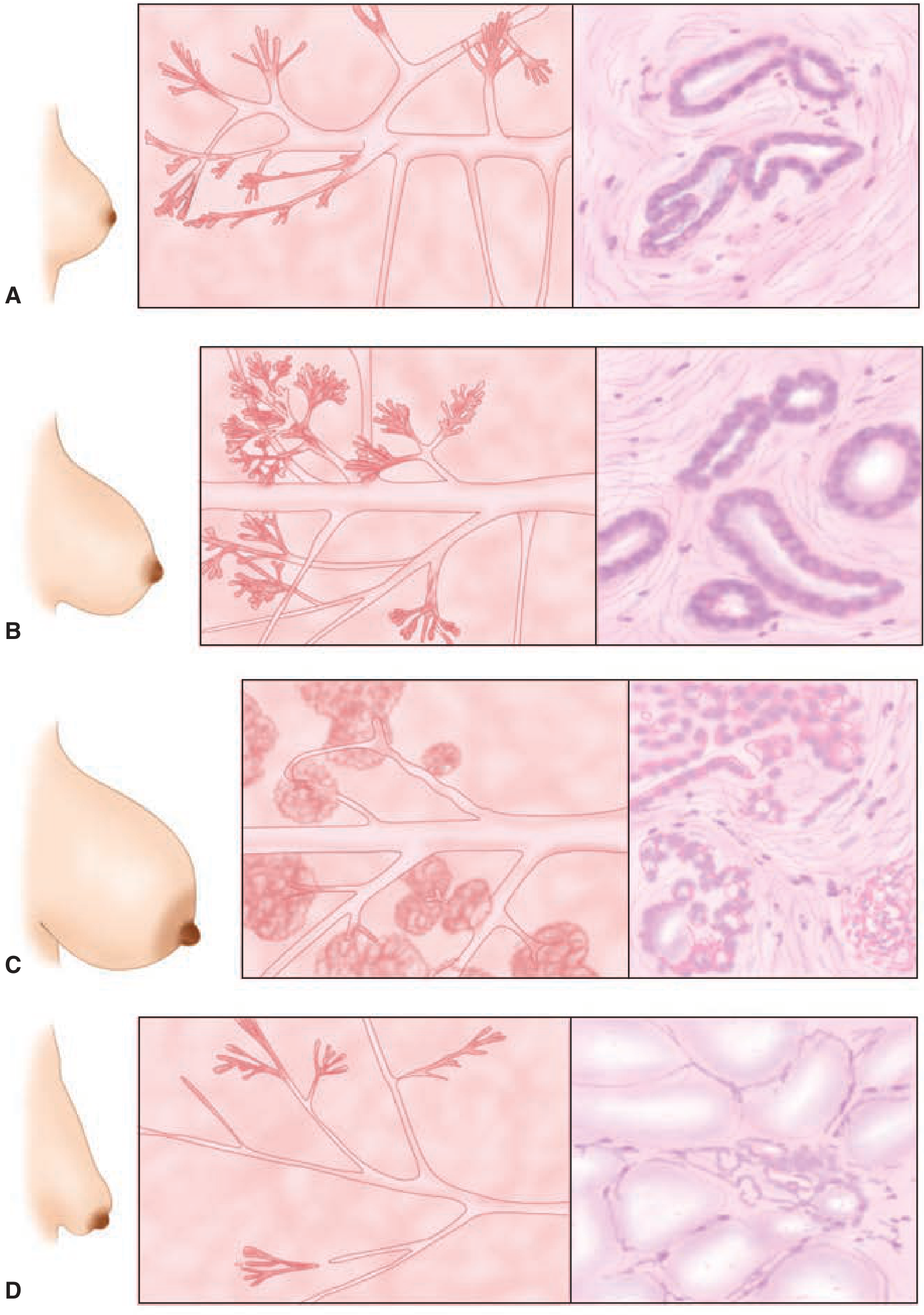 Breast at Different Physiologic Stages — A:Adolescence B:Pregnancy C:Lactation D:Senescence