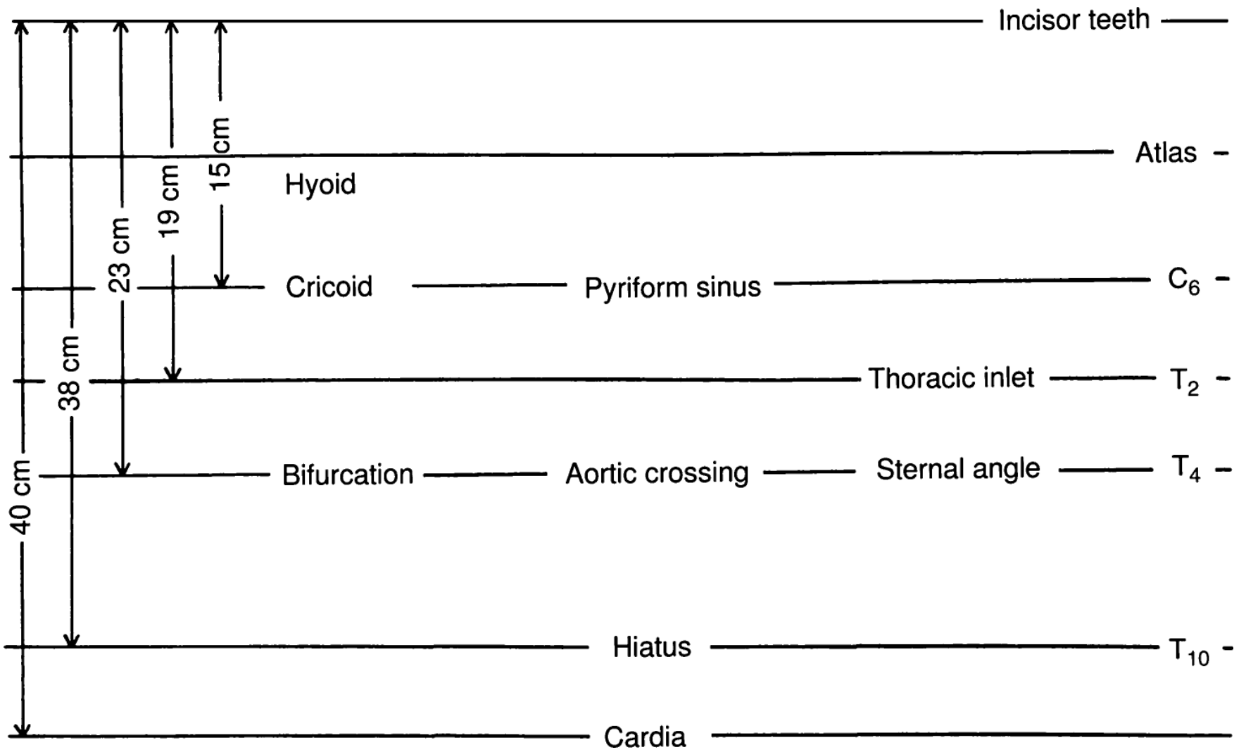 Relative landmarks for esophagoscopy showing distances from incisor teeth to anatomical landmarks