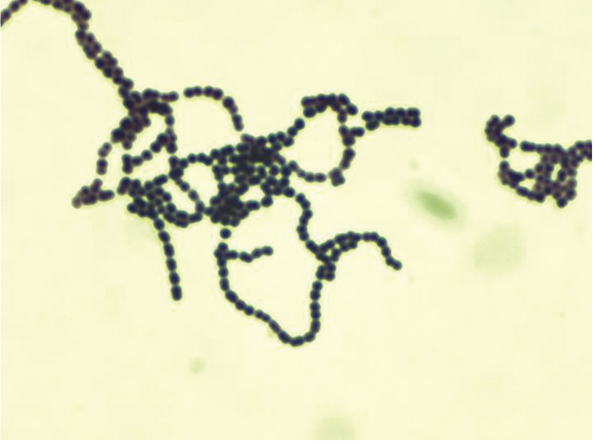 Gram stain of Streptococcus pyogenes showing gram-positive cocci arranged in long chains