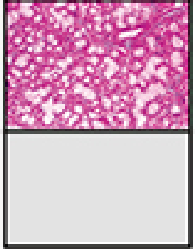 Sublingual gland H&E x160 - predominantly mucous acini