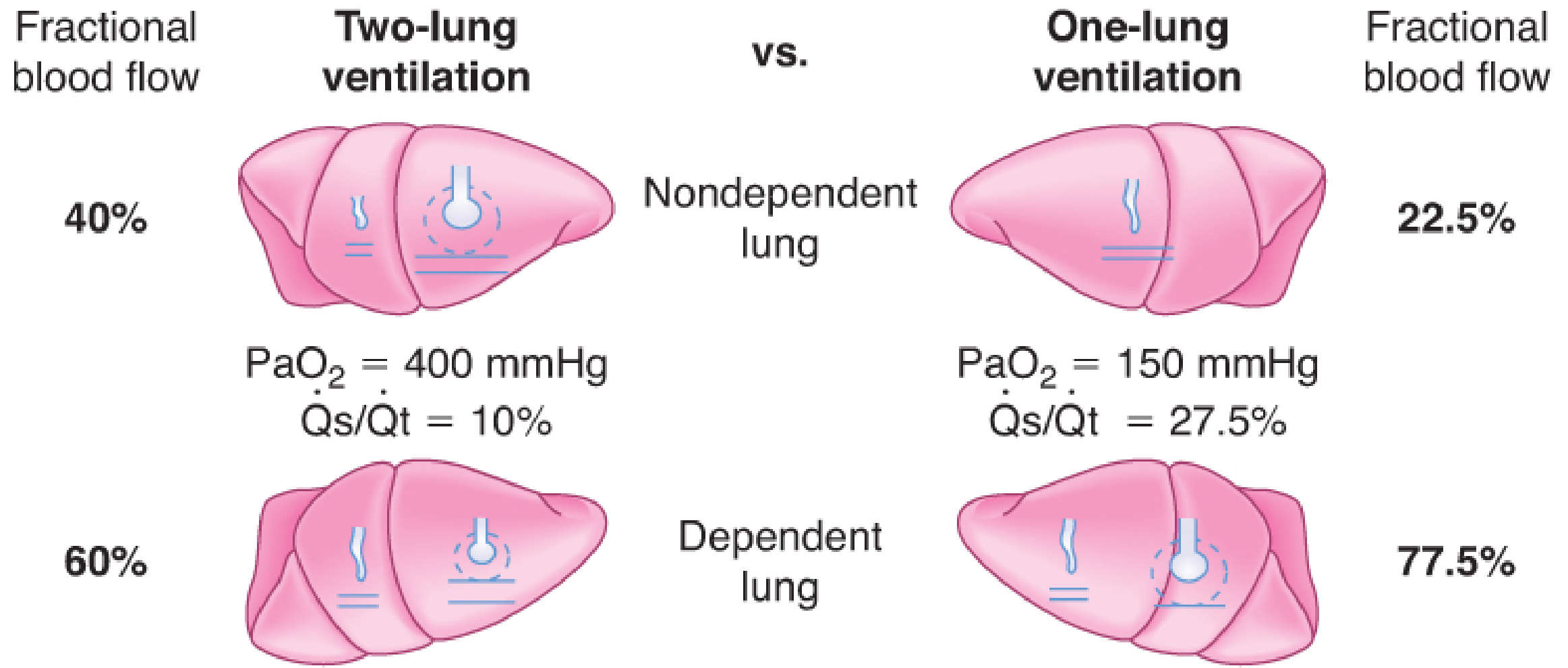 Two-lung vs One-lung ventilation: blood flow distribution and shunt fractions