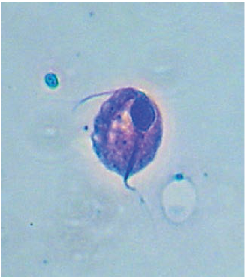 Trichomonad organism on microscopy - flagellated protozoan