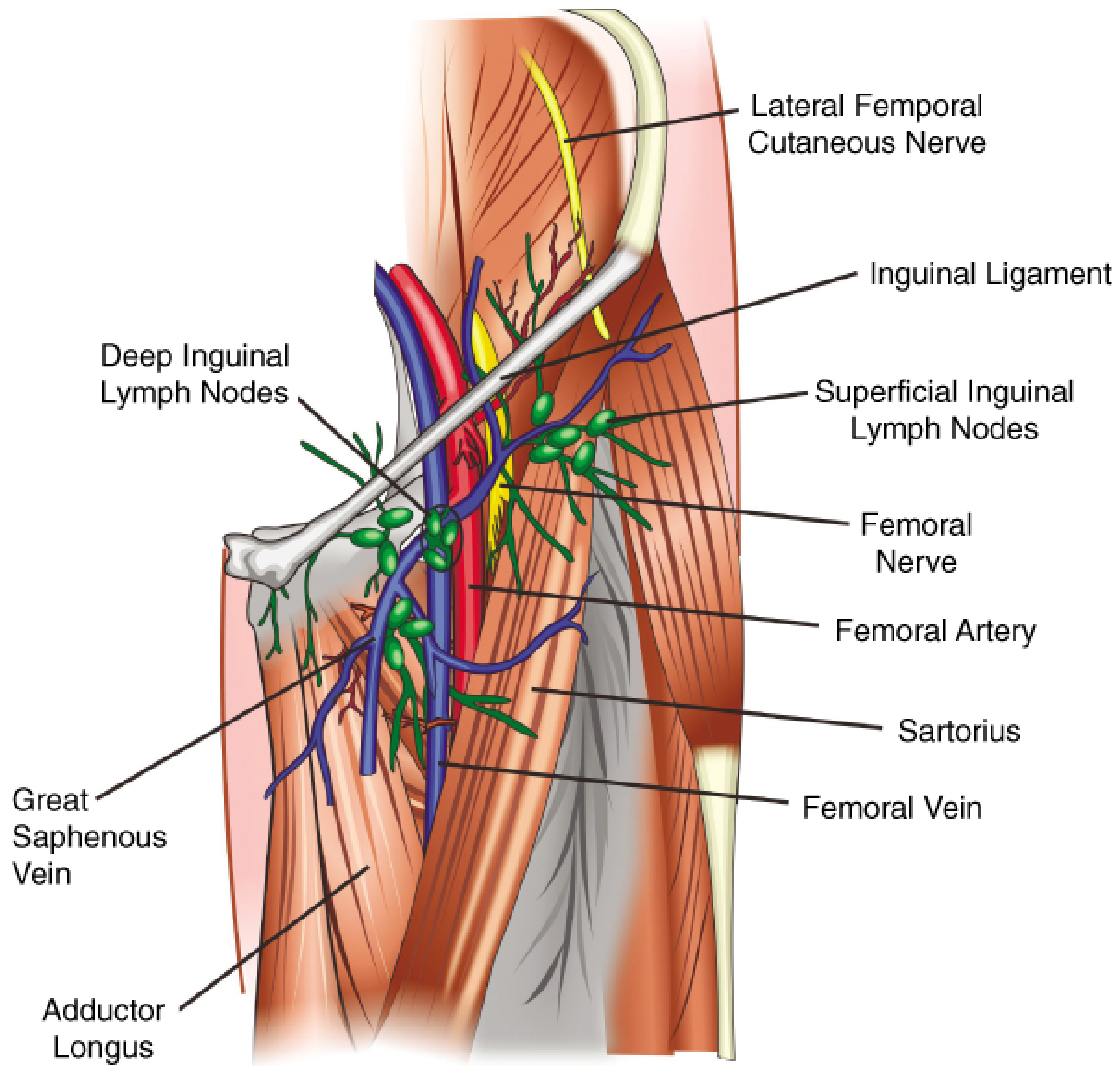 Anatomy of the femoral triangle showing femoral nerve, artery, vein, sartorius, adductor longus, inguinal lymph nodes, and great saphenous vein