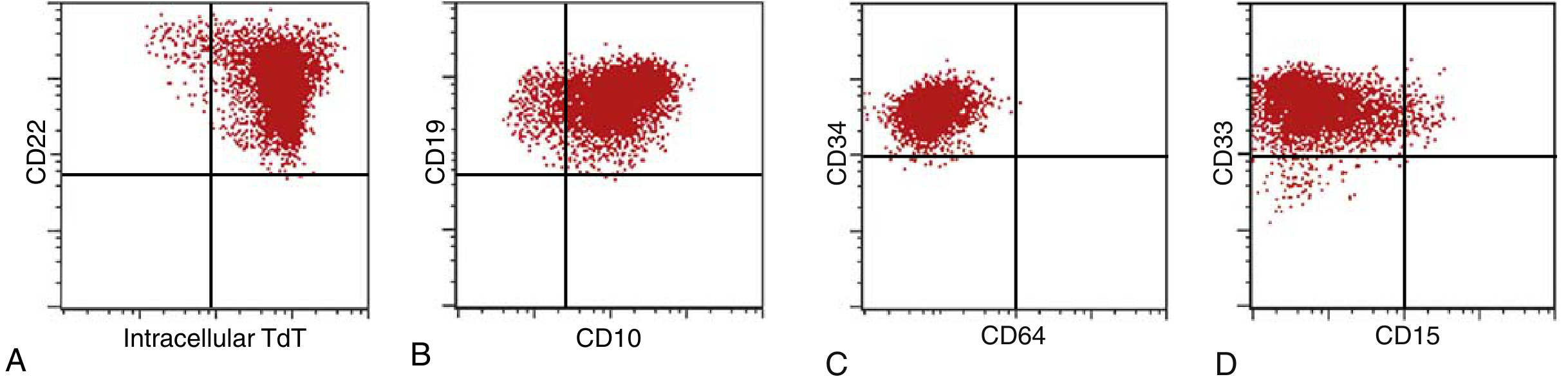 Flow cytometry ALL vs AML - TdT, CD19, CD22, CD10, CD34, CD33, CD15, CD64
