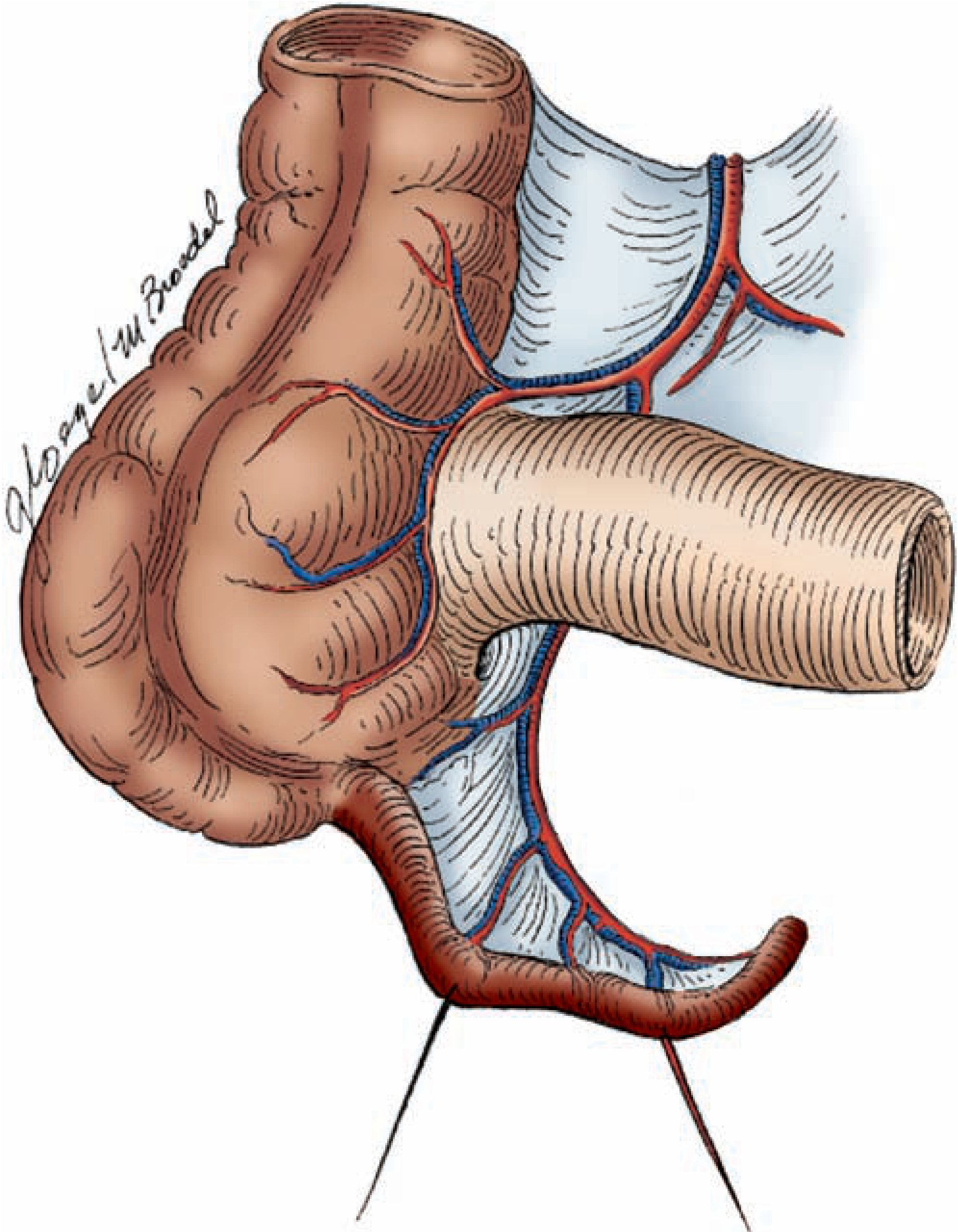 Fig. 31-2 The appendix and its arterial supply - Maingot's Abdominal Operations