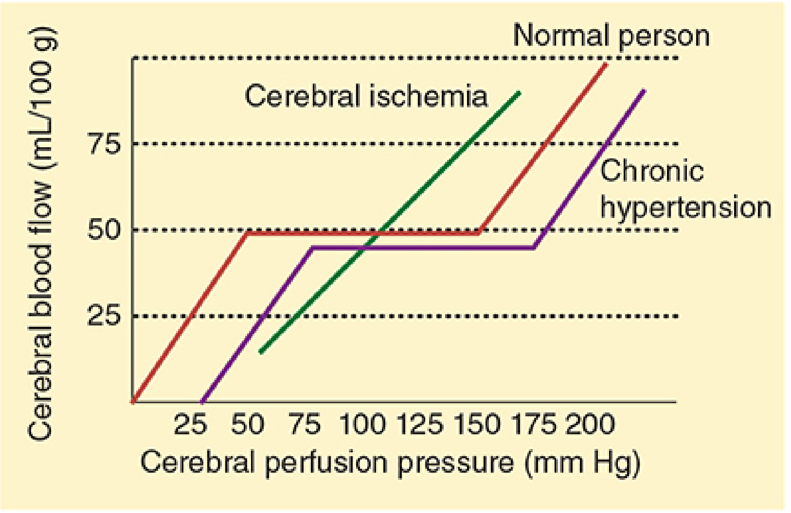 Cerebral autoregulation comparison: normal brain maintains constant CBF across perfusion pressures; in cerebral ischemia, flow is entirely pressure-dependent (linear curve with no plateau)