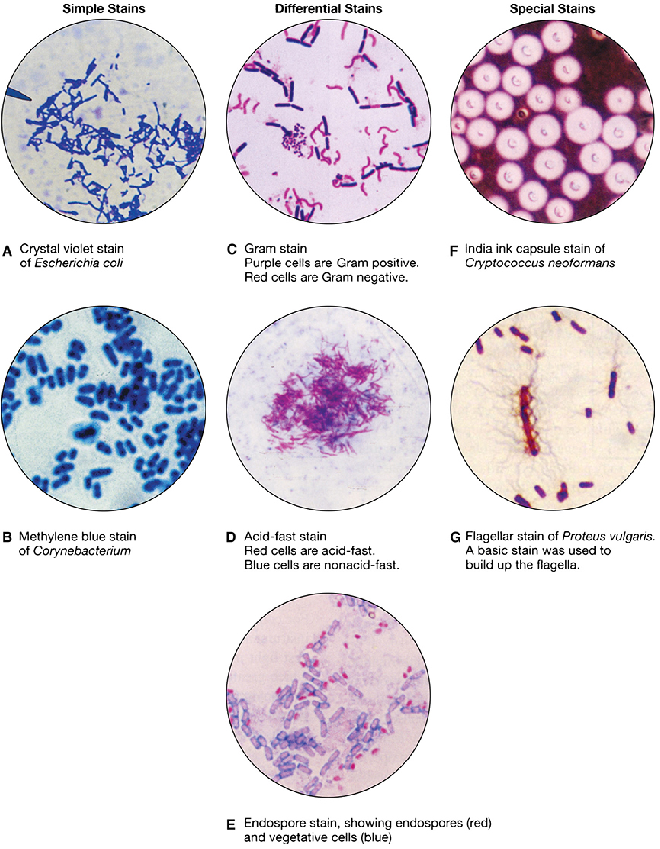 Types of microbiologic stains including acid-fast stain showing red acid-fast organisms against blue background