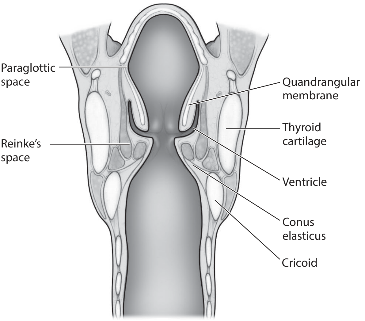 Coronal view showing the paraglottic space, Reinke's space, and related structures - KJ Lee's Essential Otolaryngology