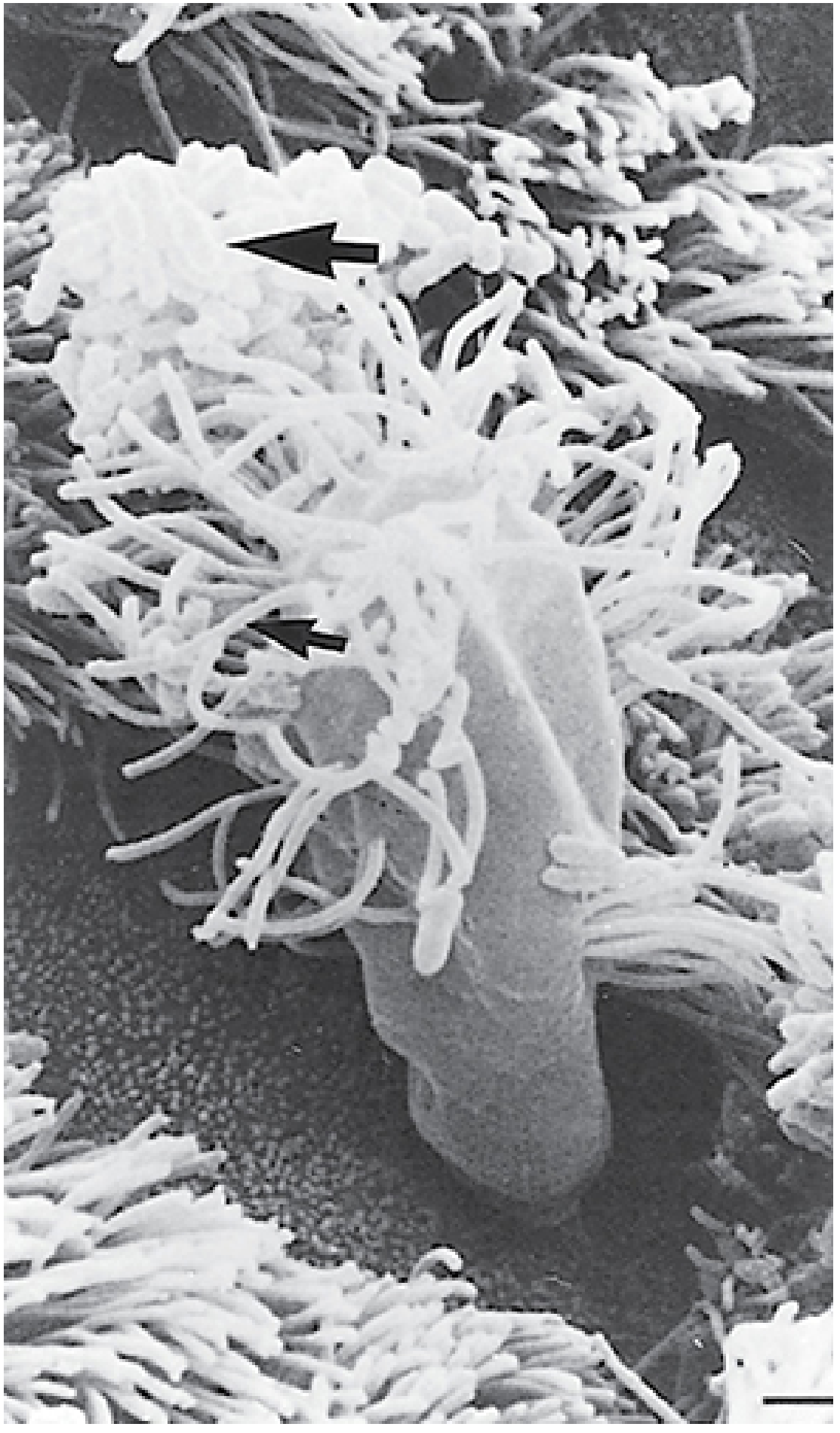 Scanning electron micrograph of tracheal organ culture 72 hours post-infection with B. pertussis. The large arrow points to the Bordetella organisms; the small arrow shows cilia. Balloon-like infected ciliated cells are being extruded from the epithelium.