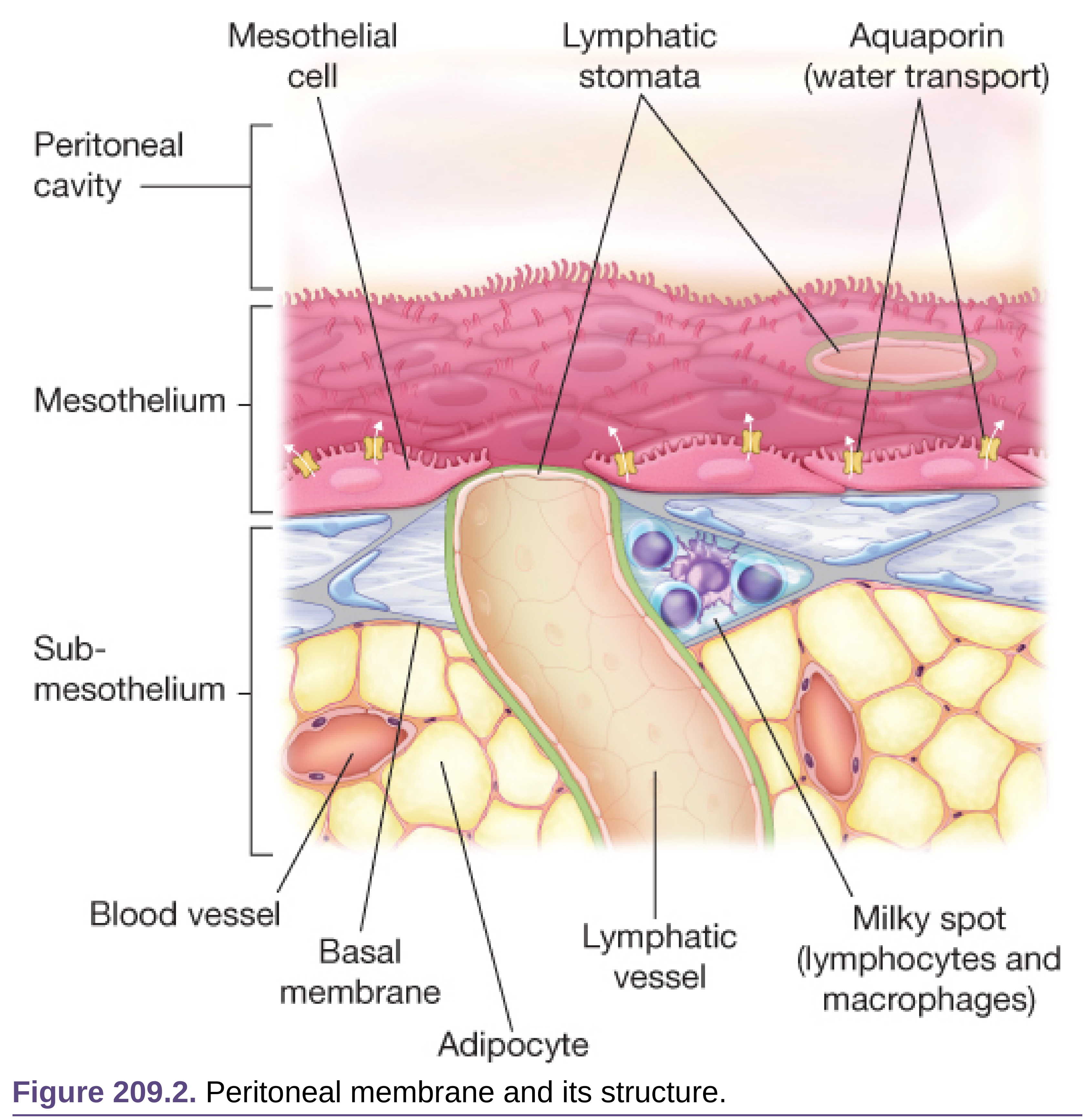 Peritoneal membrane structure showing mesothelial cell, aquaporin water channels, lymphatic stomata, blood vessels, submesothelium and milky spots