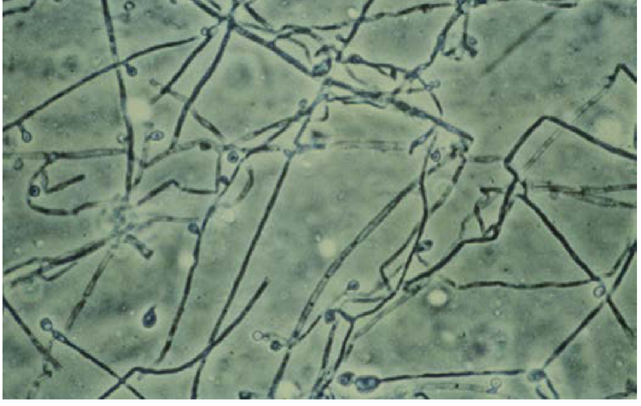 Mold form of Blastomyces dermatitidis in culture showing "lollipop" appearance of conidia on conidiophore (Lactophenol cotton blue stain, 400x)