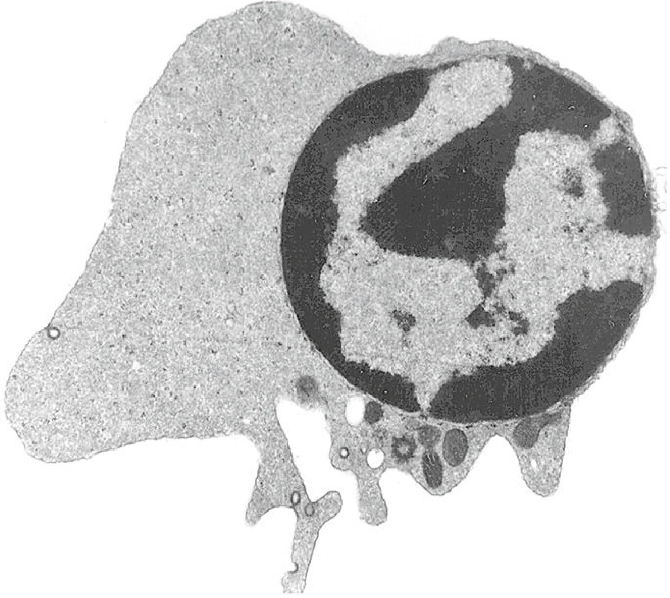 Electron micrograph of an orthochromatophilic erythroblast (normoblast) showing dense hemoglobin-rich cytoplasm and pyknotic nucleus about to be extruded