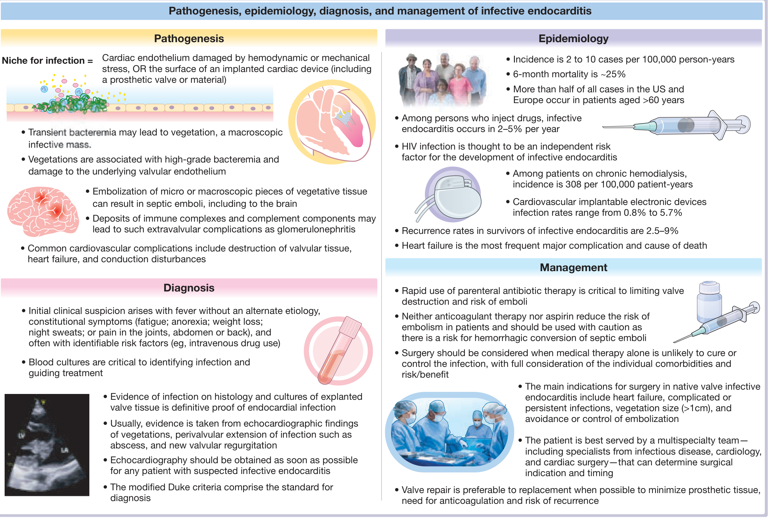 Central illustration of infective endocarditis