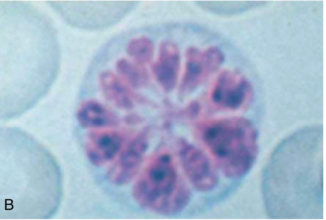ATLL Flower Cell - Harrison's