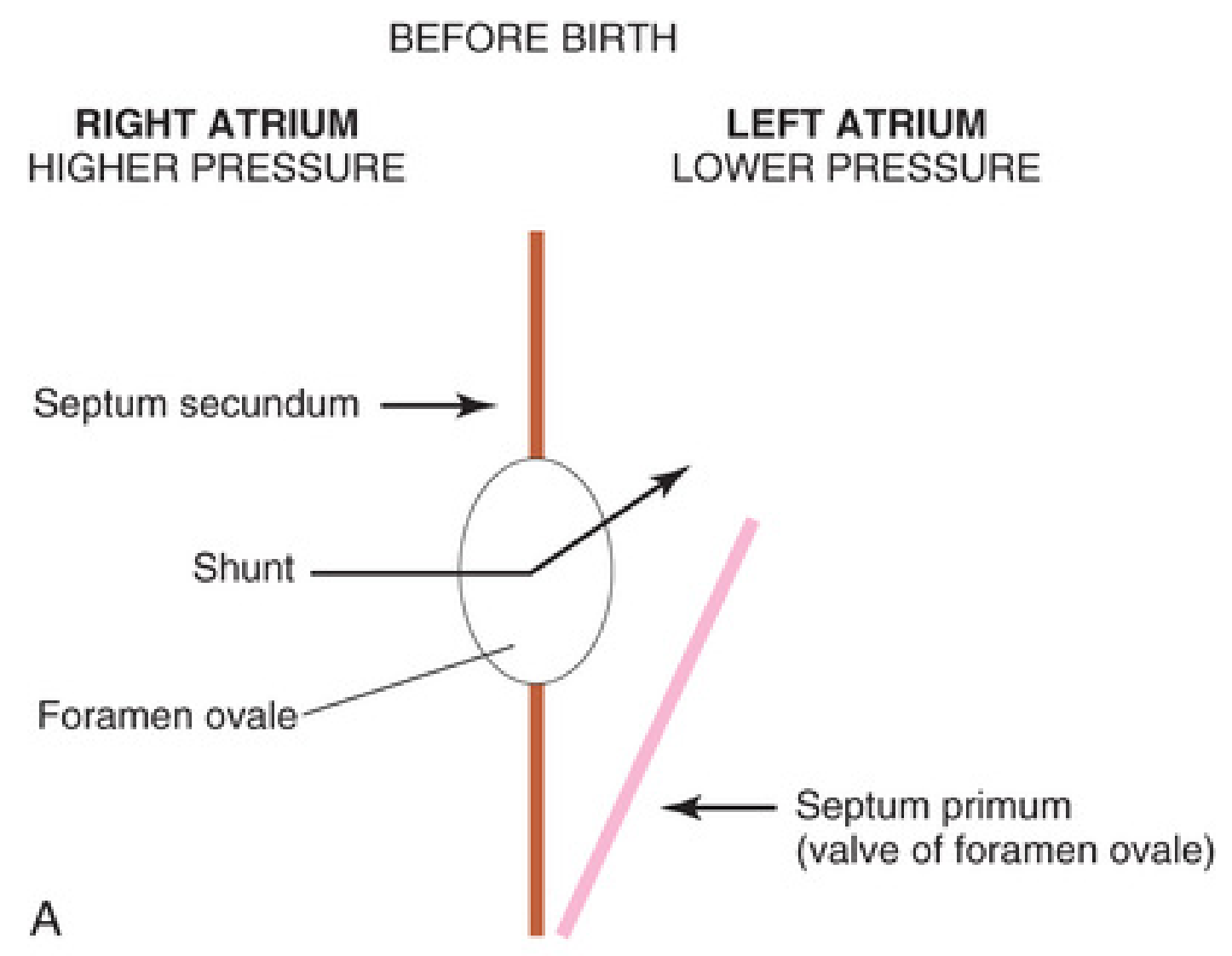 Fetal and postnatal relationship of septum primum and secundum