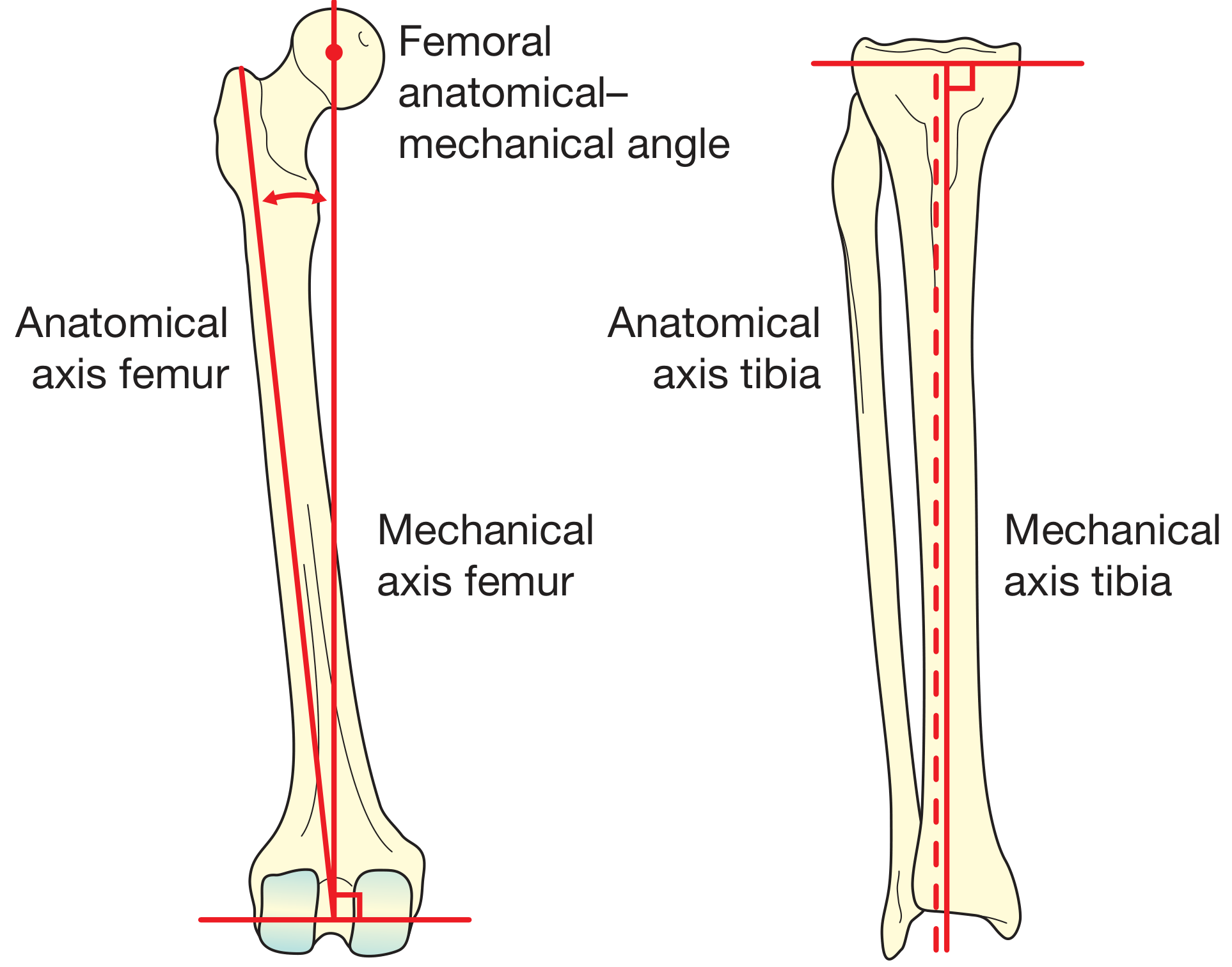 Lower limb mechanical and anatomical axes diagram