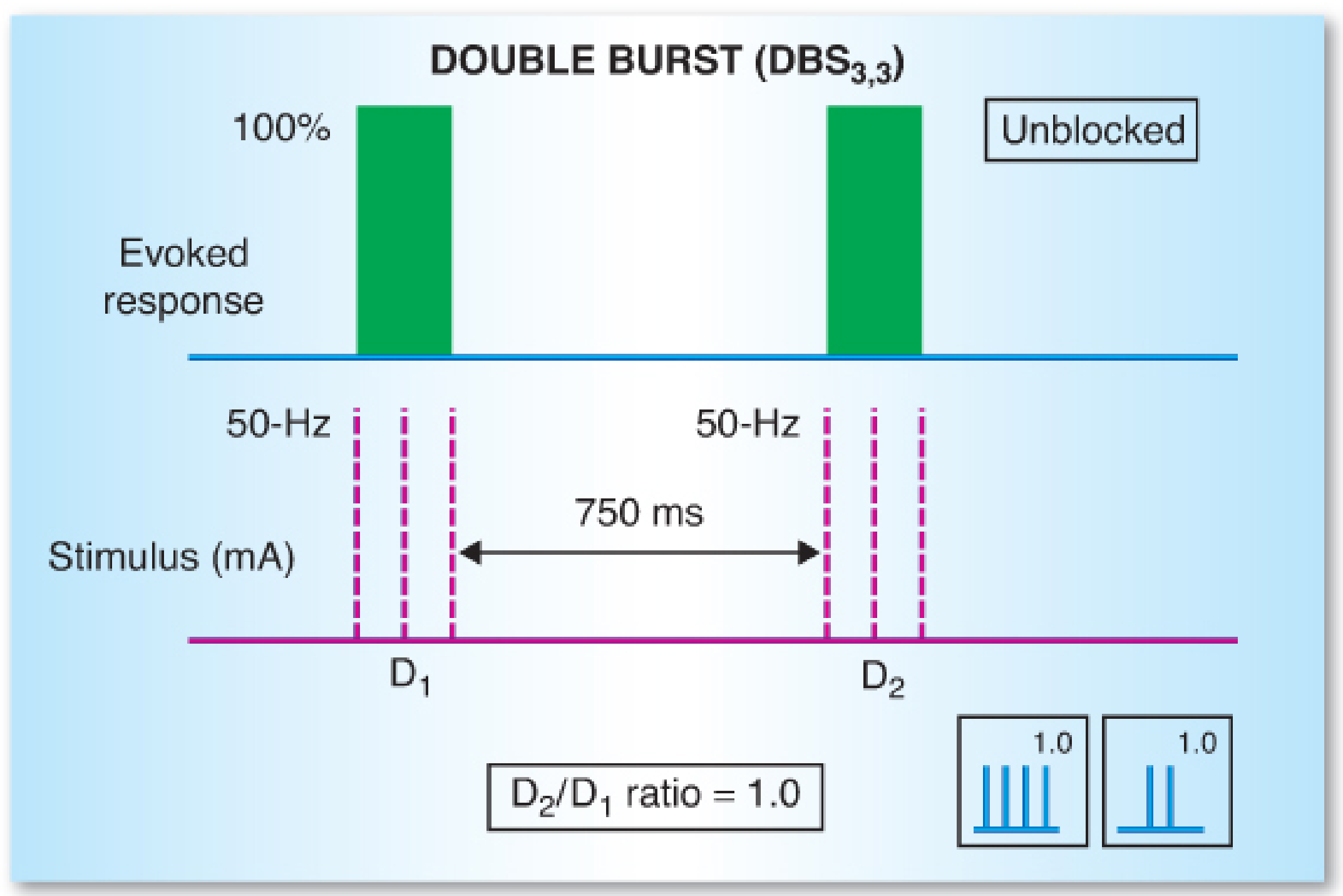 DBS₃,₃ — two 50-Hz bursts of 3 stimuli each, separated by 750 ms; D2/D1 ratio = 1.0 when unblocked