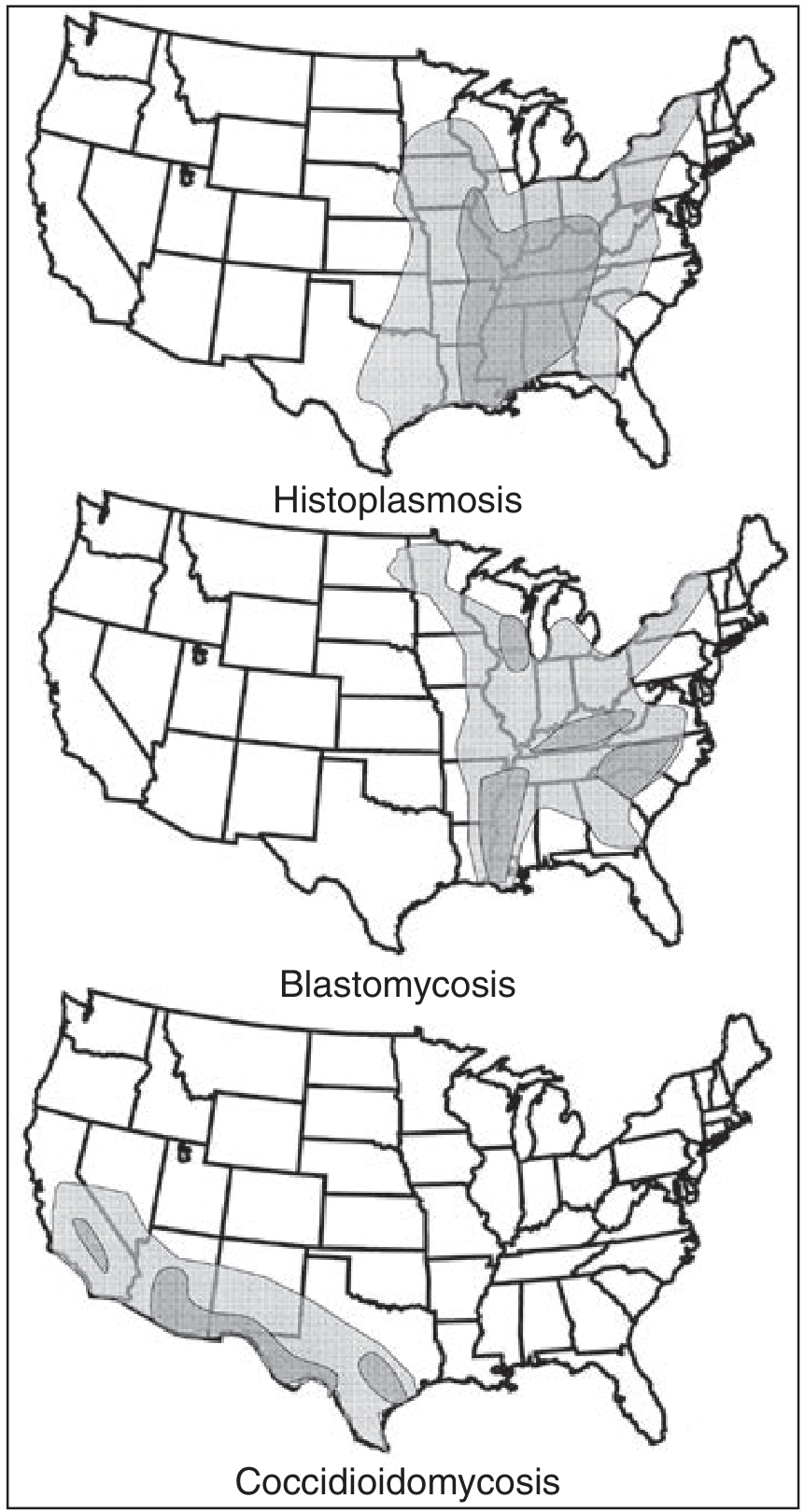 Geographic distribution of dimorphic fungal infections in the United States showing areas of greatest endemicity (dark shading) and lesser endemicity (light shading) for Histoplasmosis, Blastomycosis, and Coccidioidomycosis