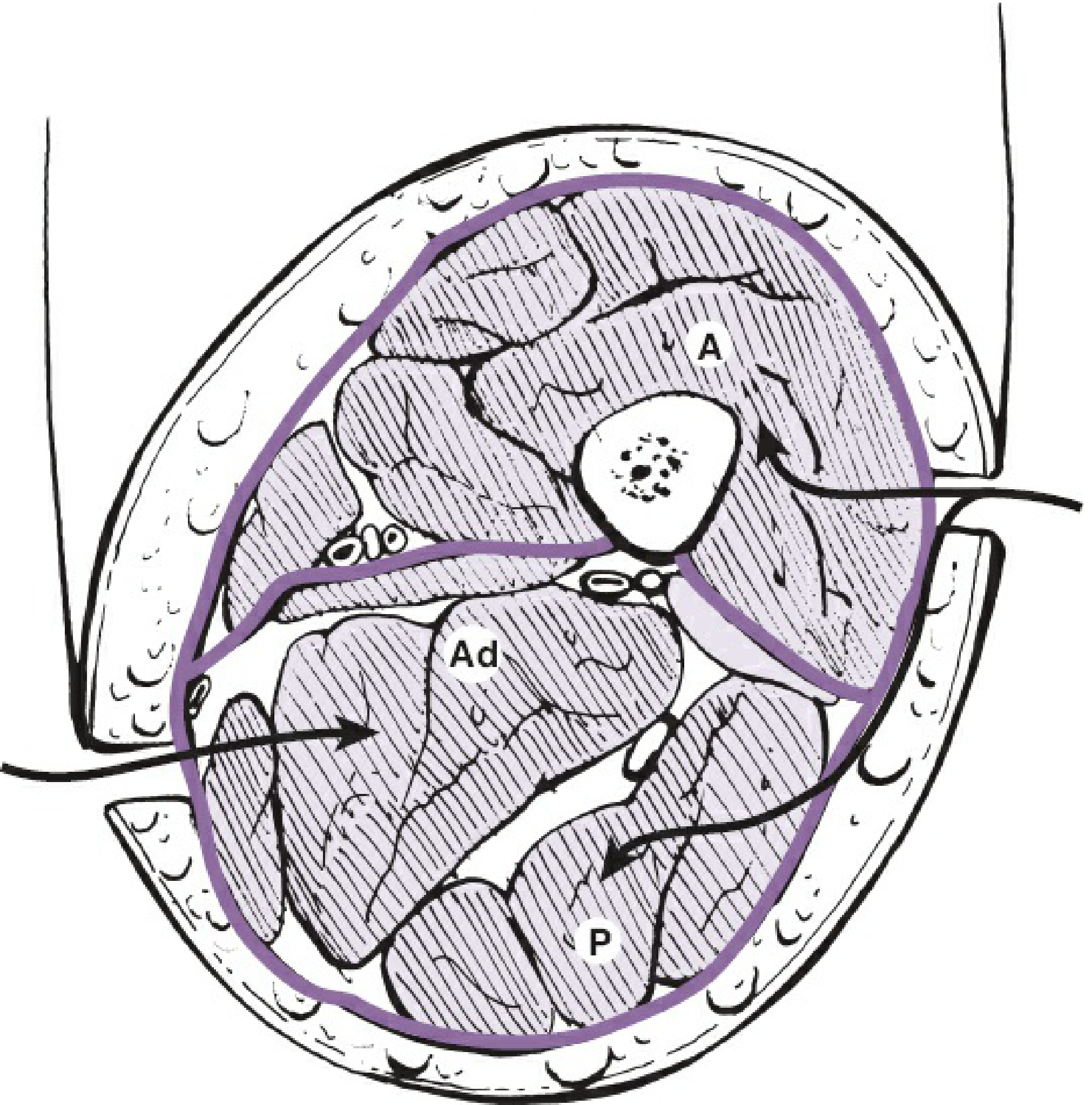 Cross-section of the thigh showing the three compartments - Anterior (A), Adductor (Ad), and Posterior (P)