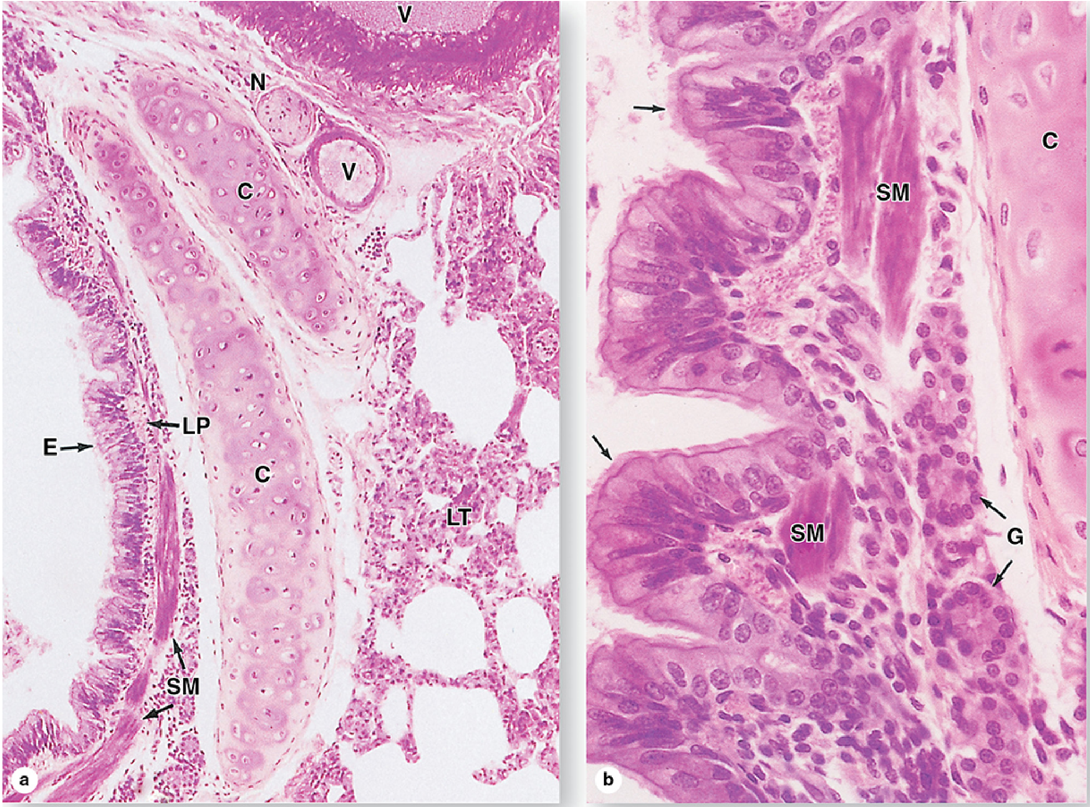 Histologic diagram of a bronchial wall, with smooth muscle labeled SM, respiratory epithelium labeled E, cartilage labeled C, and blood vessels labeled V