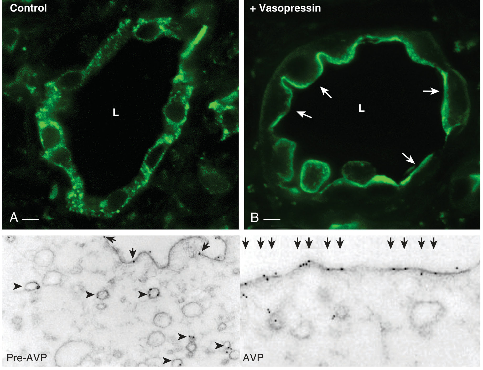 AQP2 redistribution from cytoplasmic vesicles to apical membrane after vasopressin treatment, shown by immunofluorescence and immunogold EM