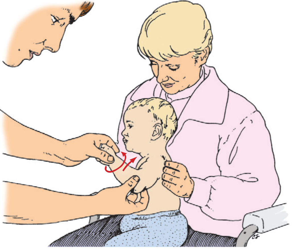 Hyperpronation and flexion method for pulled elbow reduction