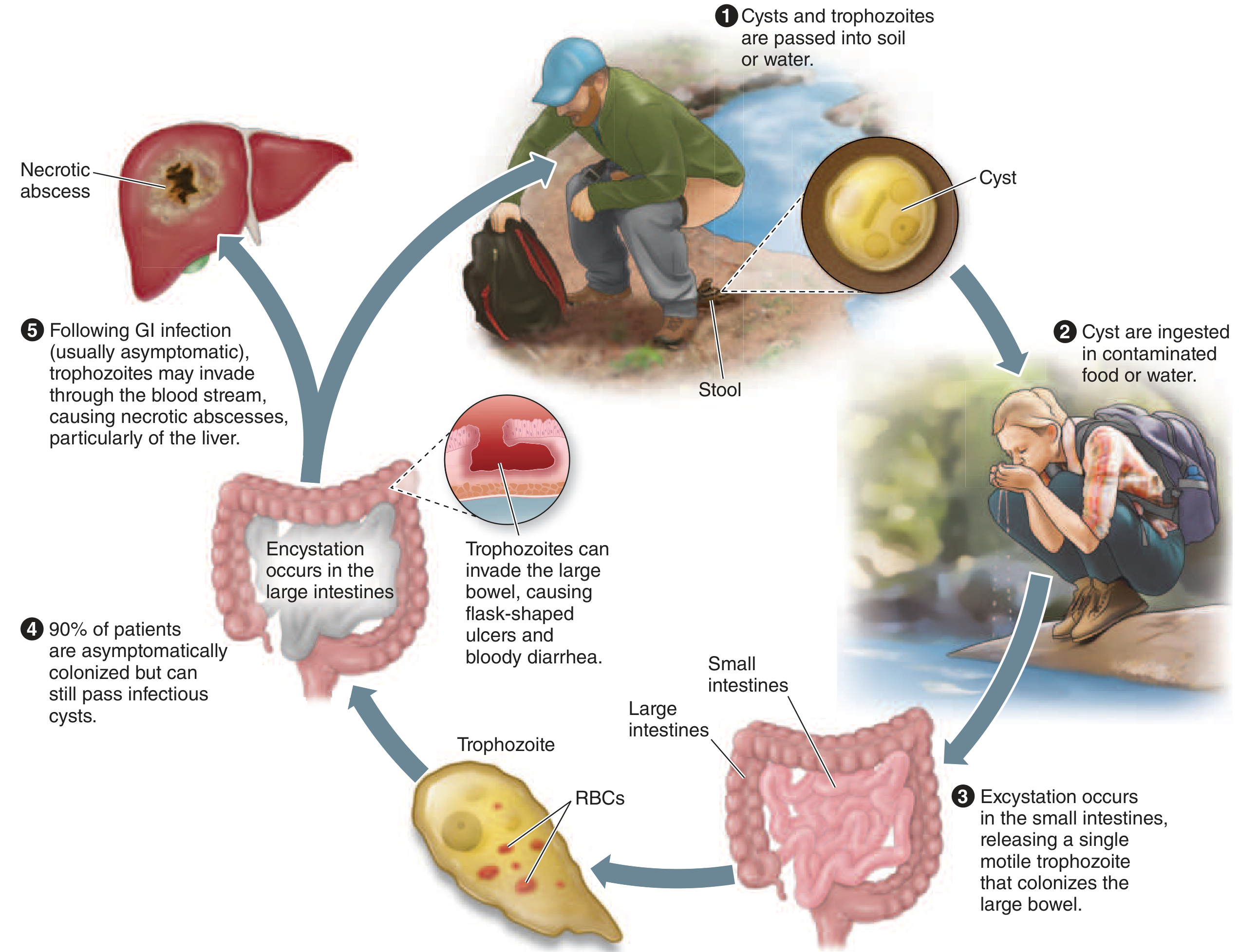 Life cycle of E. histolytica showing cyst ingestion, excystation, trophozoite invasion, encystation, and hepatic abscess formation
