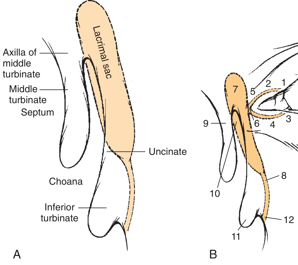 Anatomy of lacrimal apparatus in relation to nasal structures - key landmarks for DCR surgery