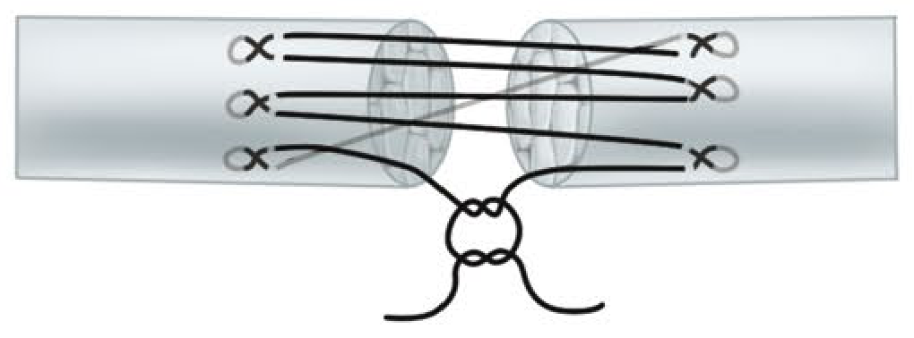 Savage multi-strand modification - parallel strands crossing repair