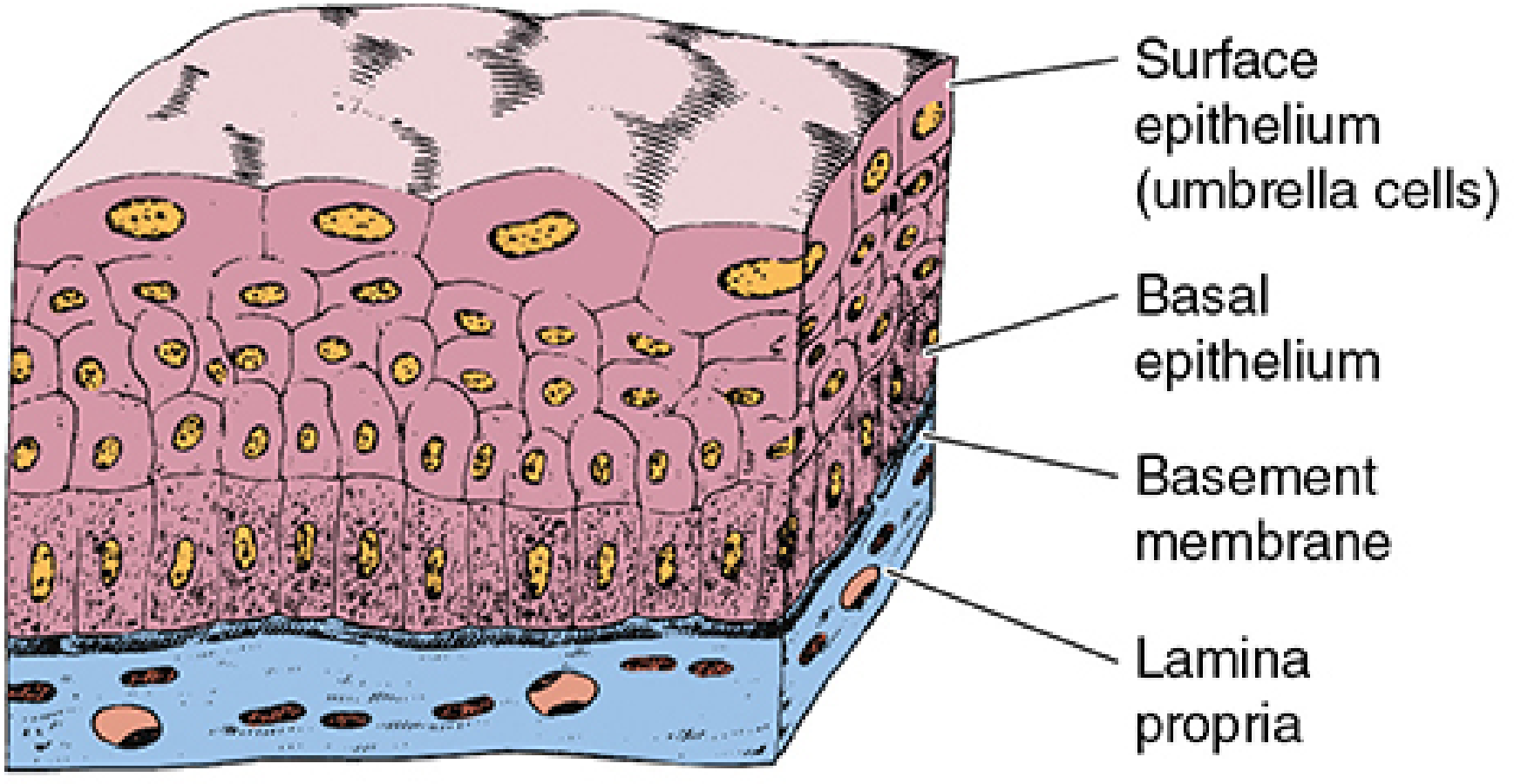 Transitional epithelium (urothelium) 3D diagram: large dome-shaped umbrella cells at surface, multiple rounded cell layers beneath, basement membrane, and lamina propria. Labels: surface epithelium (umbrella cells), basal epithelium, basement membrane, lamina propria
