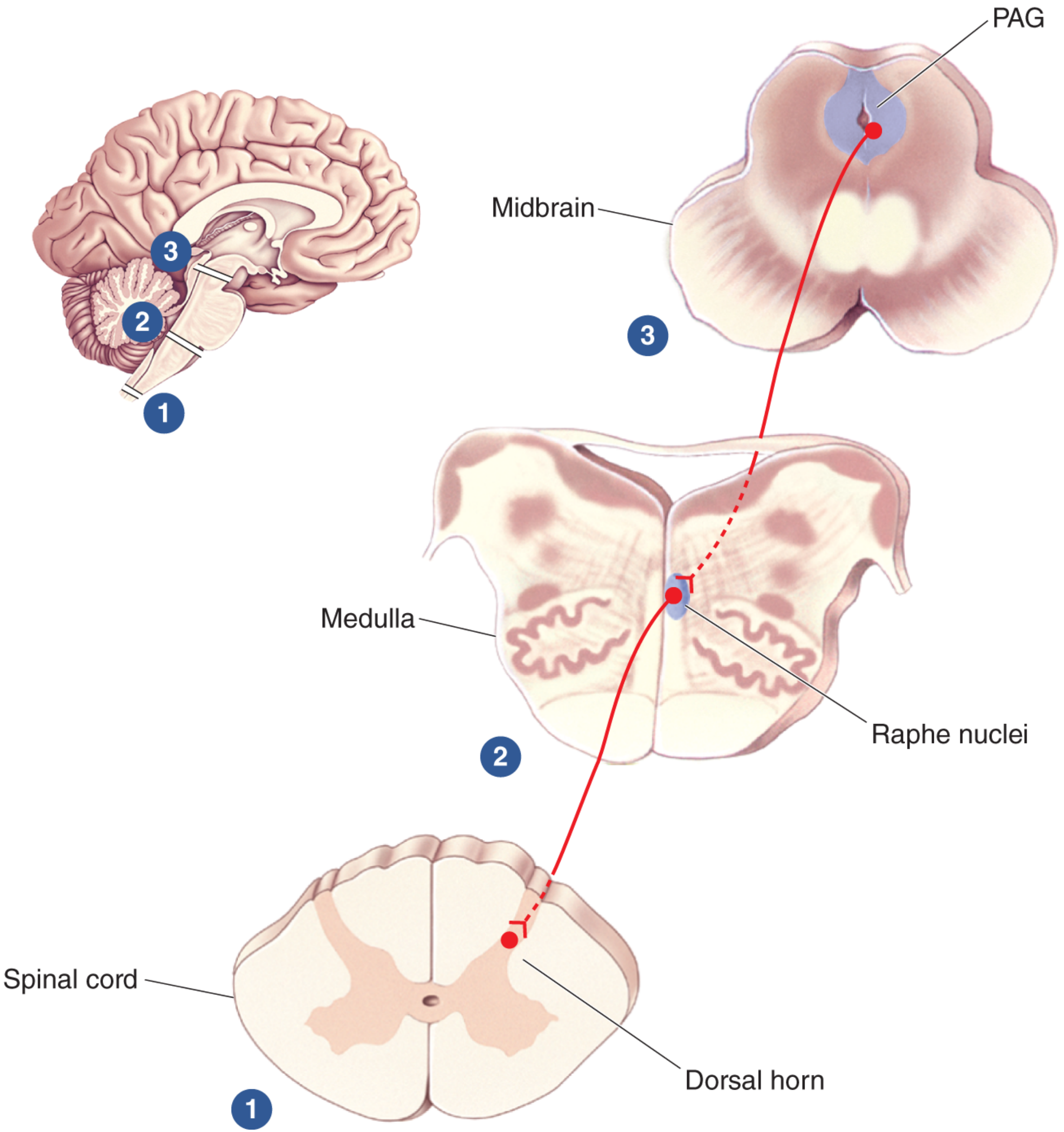 Descending pain-control pathway showing PAG, raphe nuclei, and dorsal horn