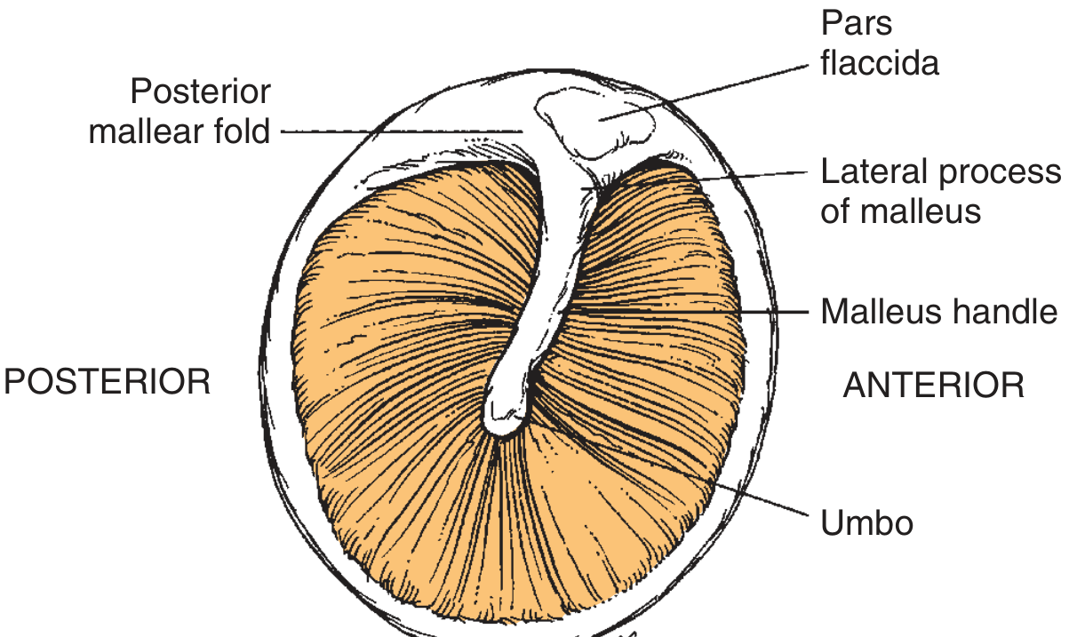 Tympanic membrane landmarks - pars flaccida, posterior mallear fold, lateral process of malleus, malleus handle, umbo