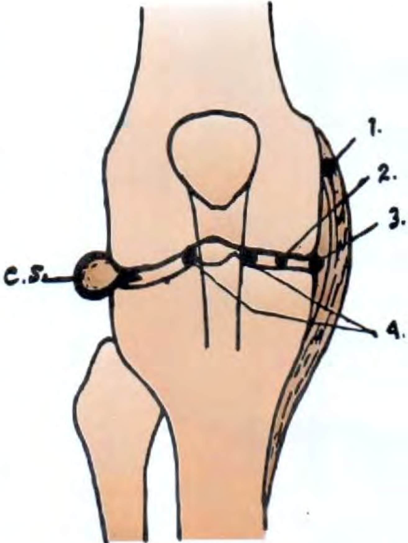 Points of tenderness in knee pathology