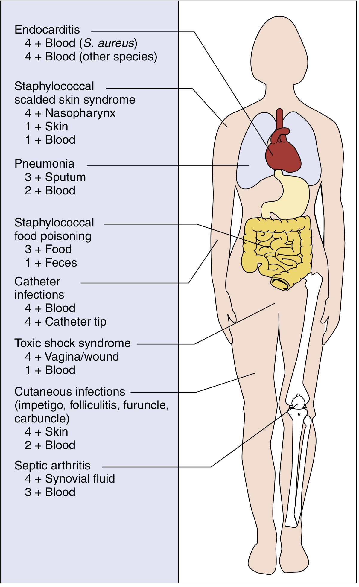 Staphylococcal diseases - sites of infection and culture positivity