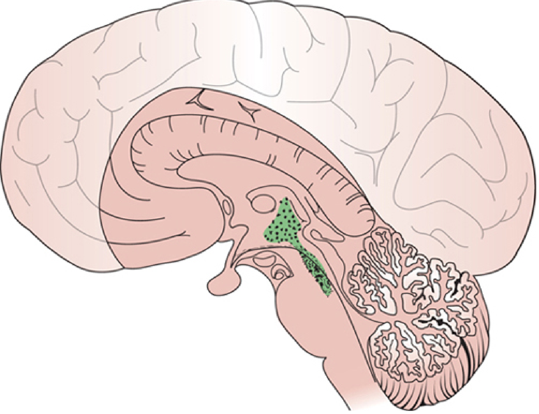 ARAS location in the brainstem - sagittal view showing the green highlighted region spanning the upper brainstem and diencephalon