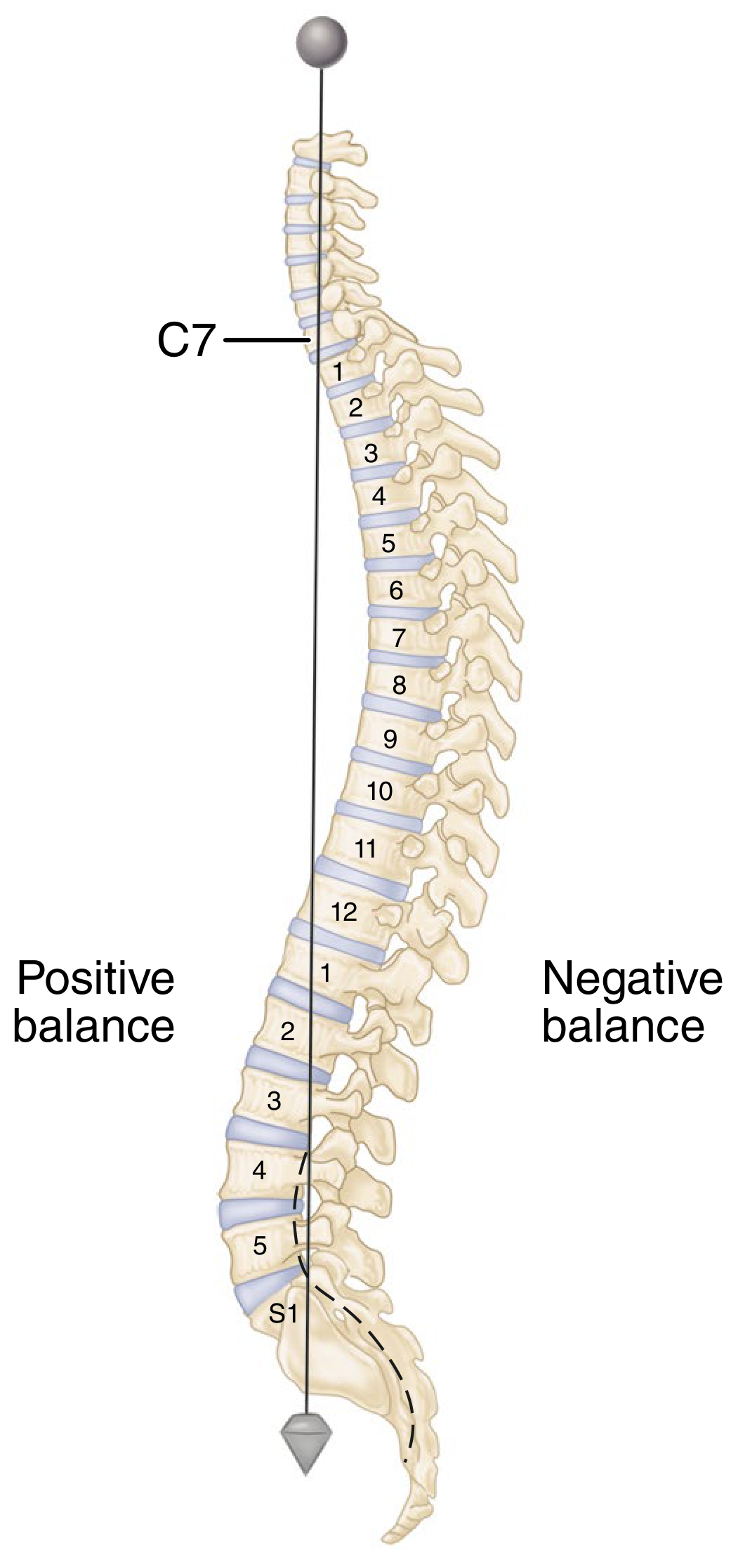 Normal sagittal spinal alignment - plumb line from C7 to S1 showing positive and negative balance
