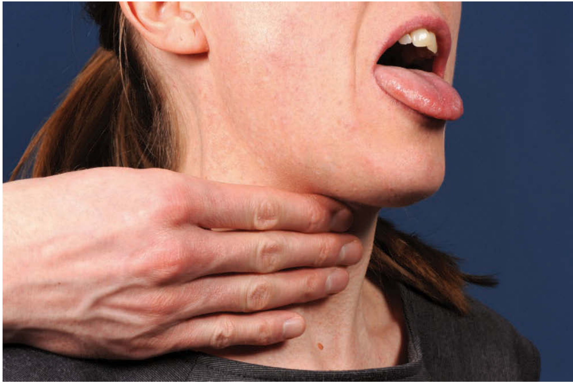 Palpation of a suspected thyroglossal cyst - patient protrudes tongue while examiner palpates neck
