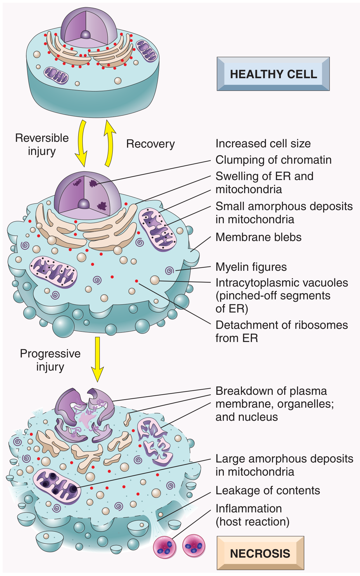 Reversible cell injury and necrosis cellular diagram