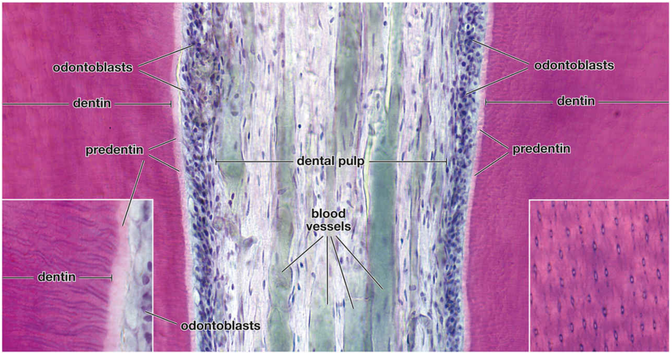 Photomicrograph showing dental pulp, dentin, odontoblasts and dentinal tubules