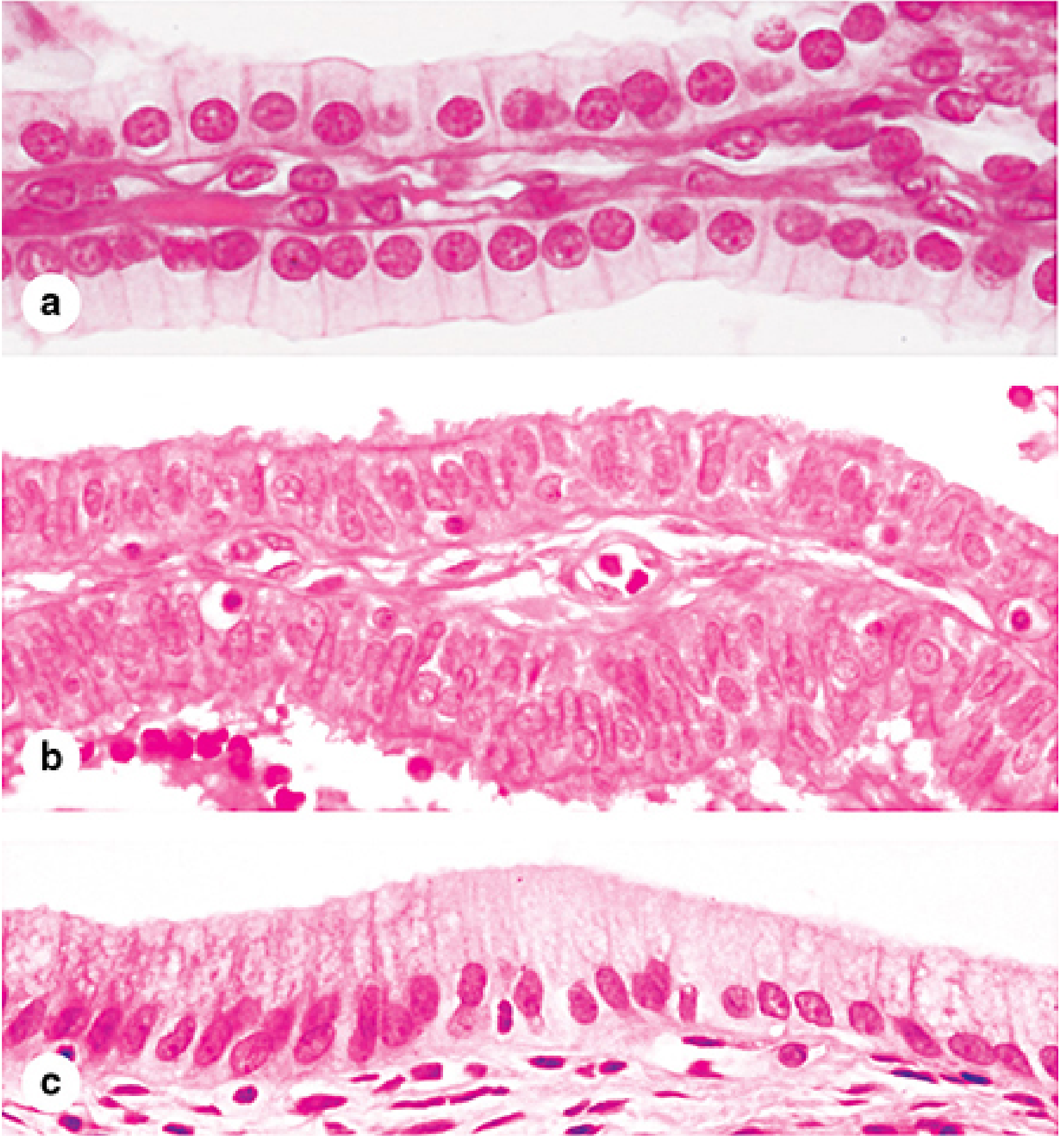 Simple columnar histology: (a) renal collecting duct; (b) oviduct with ciliated cells; (c) gallbladder lining showing tall columnar absorptive cells