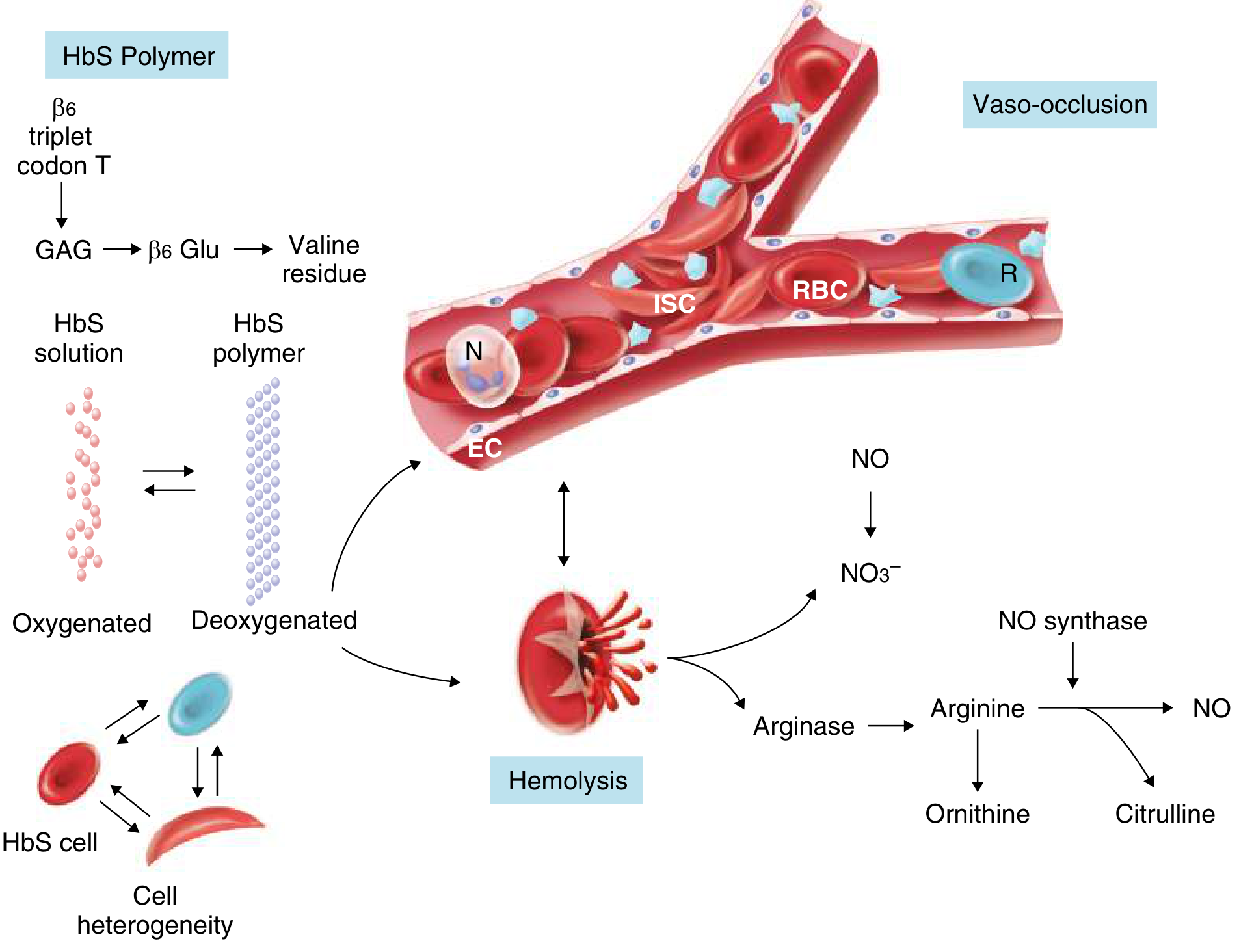 Pathophysiology of sickle cell disease - HbS polymer formation, hemolysis, vaso-occlusion, and nitric oxide depletion