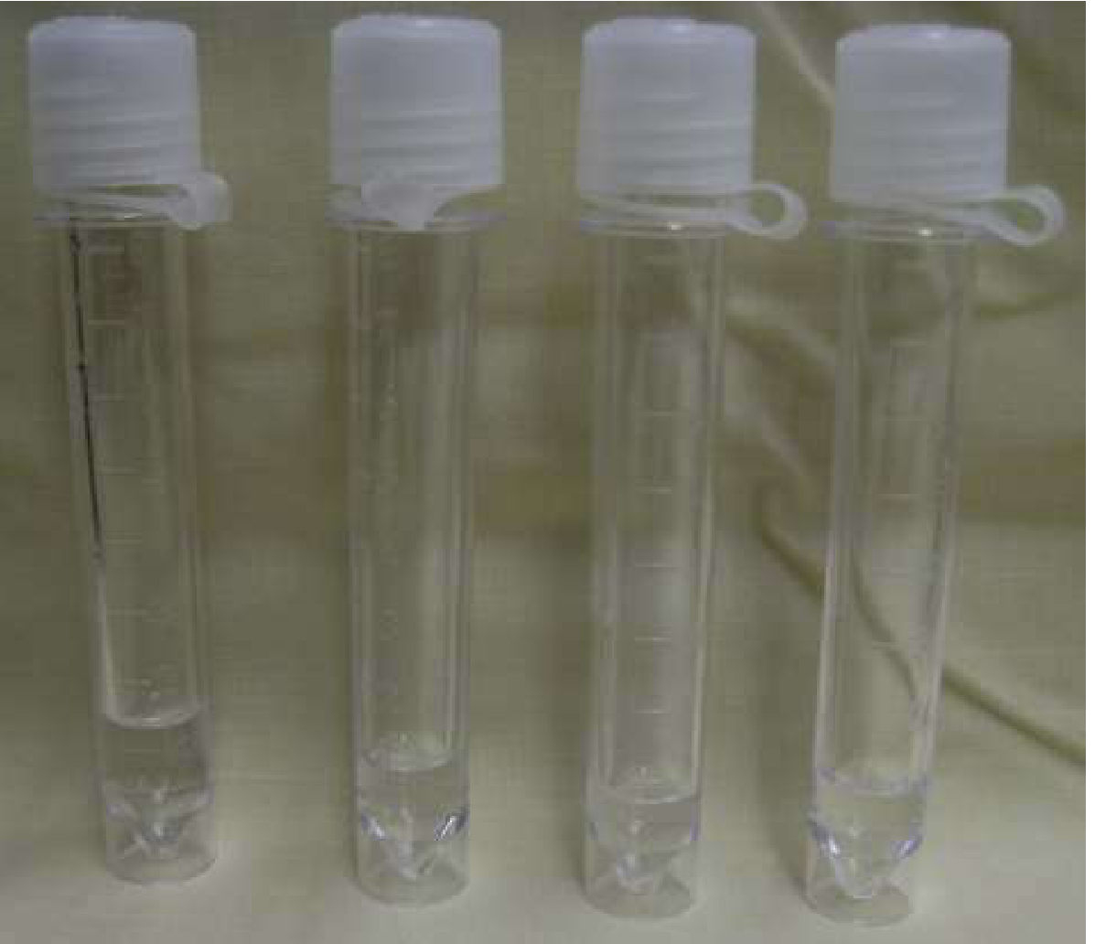 Normal CSF specimens - clear appearance indistinguishable from water; any cloudiness is pathologic