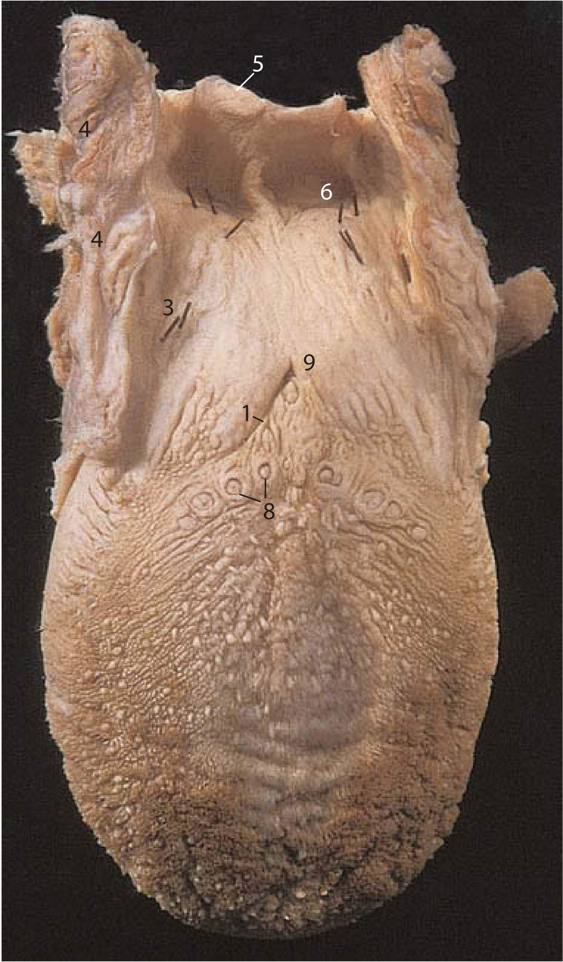 Dorsum of tongue - sulcus terminalis, circumvallate papillae, foramen caecum, lingual follicles