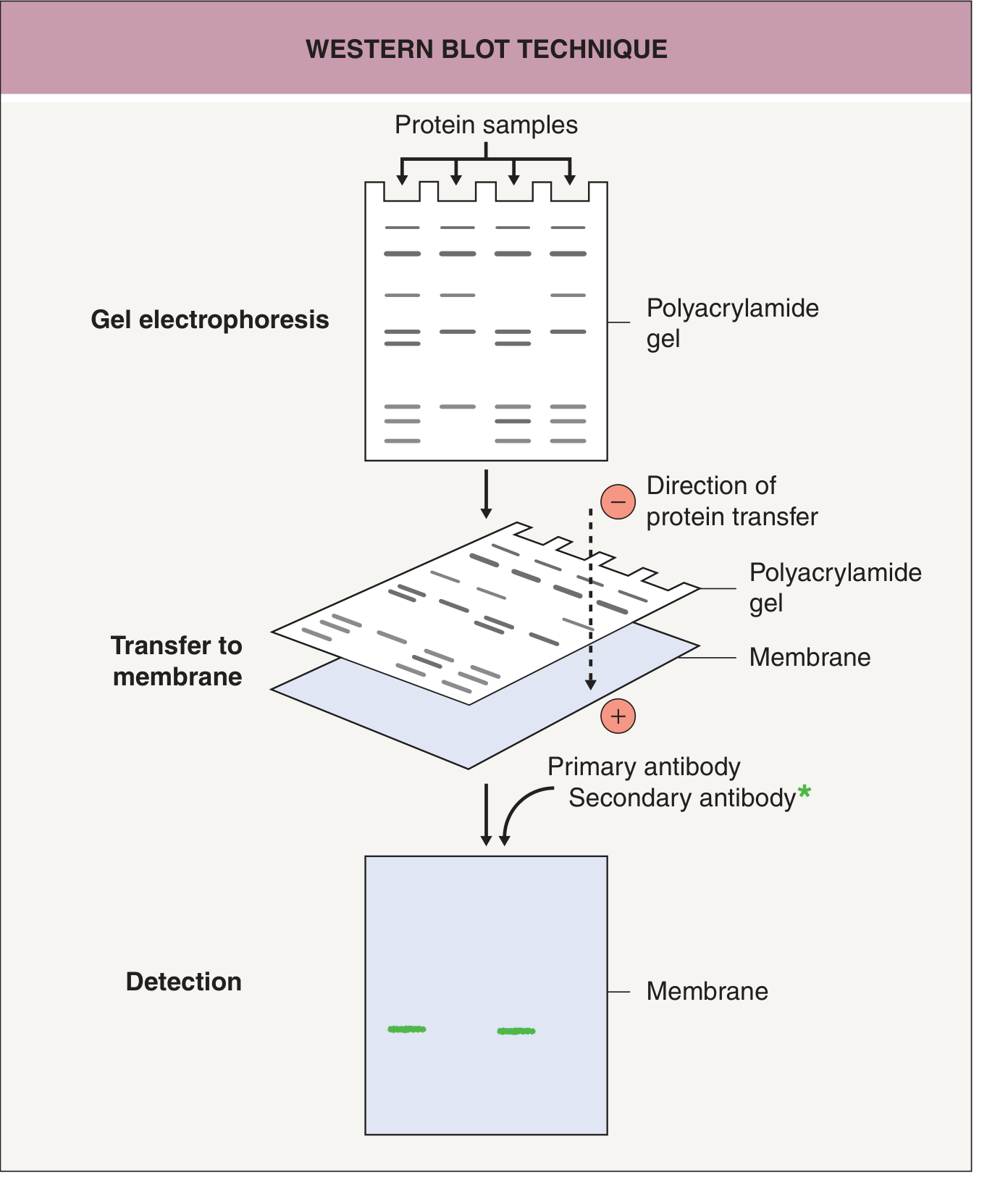 Western blot technique diagram showing the three stages: gel electrophoresis, transfer to membrane, and detection