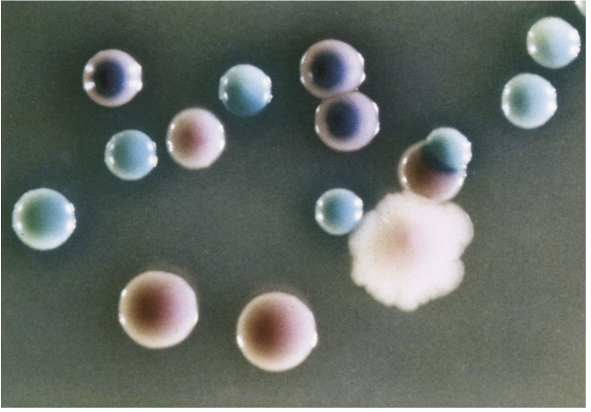 CHROMagar Candida: green C. albicans, blue-gray C. tropicalis, large rough pale pink C. krusei