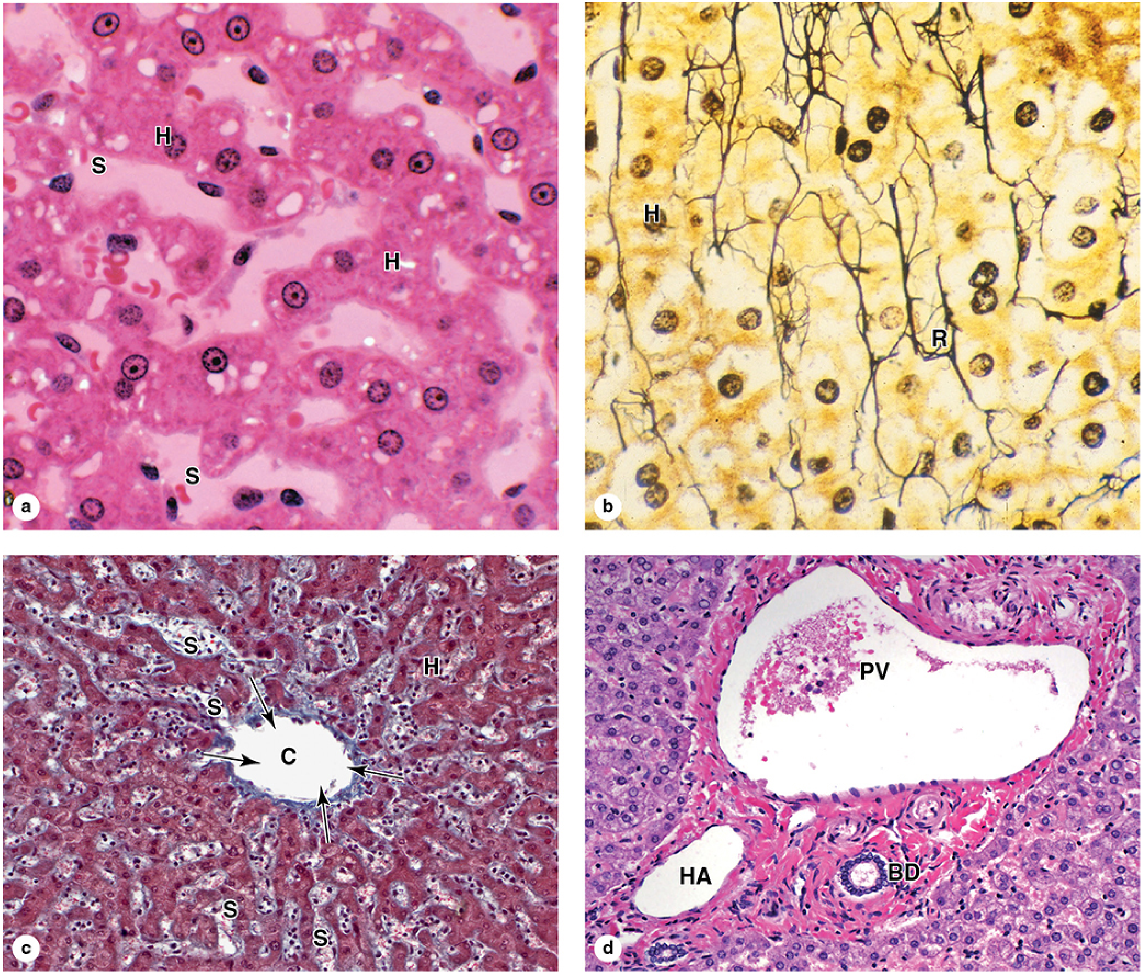 Hepatic Lobule Microvasculature Micrographs - Junqueira's Basic Histology
