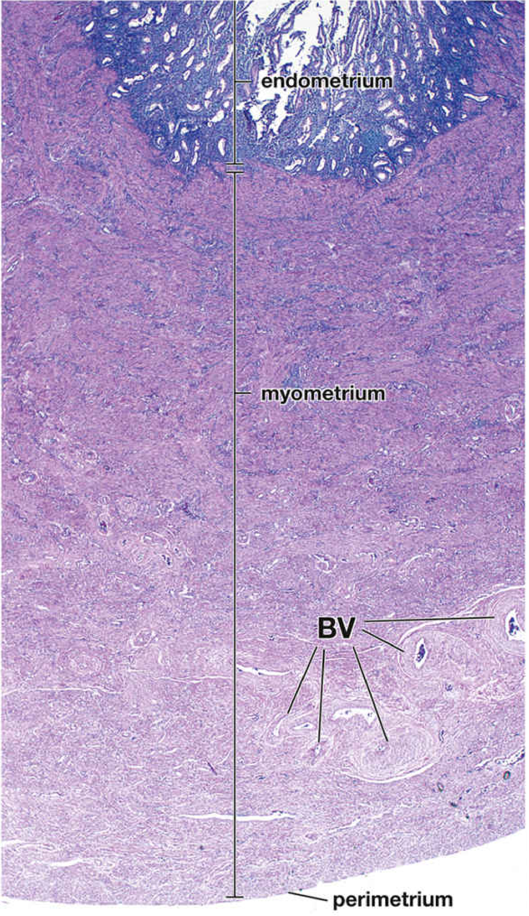 Photomicrograph of uterine wall showing endometrium, myometrium, and perimetrium layers with blood vessels (BV) visible in the deep myometrium - Histology: A Text and Atlas