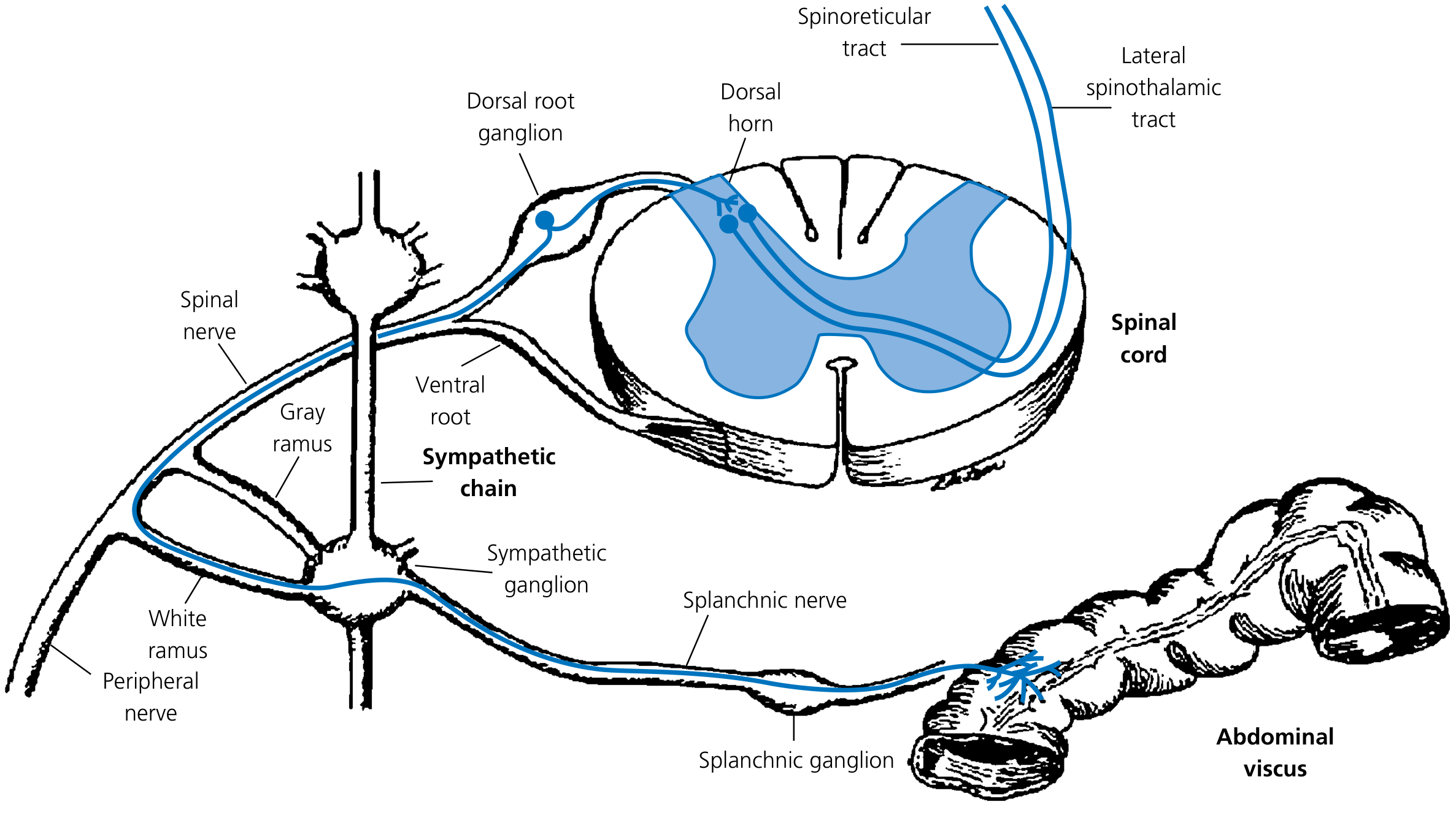 Classic visceral pain neuronal pathway — spinothalamic and spinoreticular tracts; splanchnic nerve → sympathetic chain → dorsal horn → thalamus → cortex